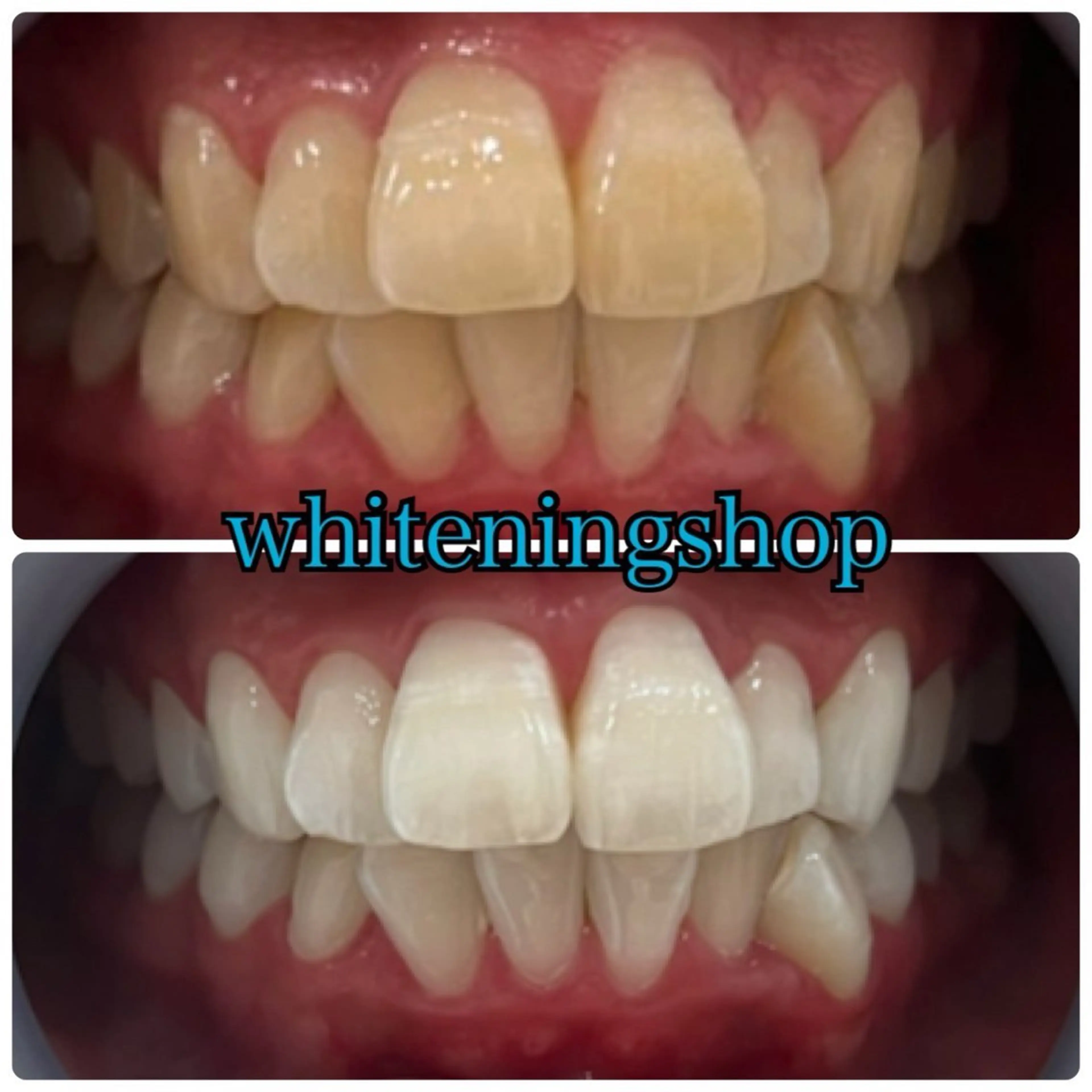 メンズ ホワイトニング ショップ川越店のエステ・リラクイメージ