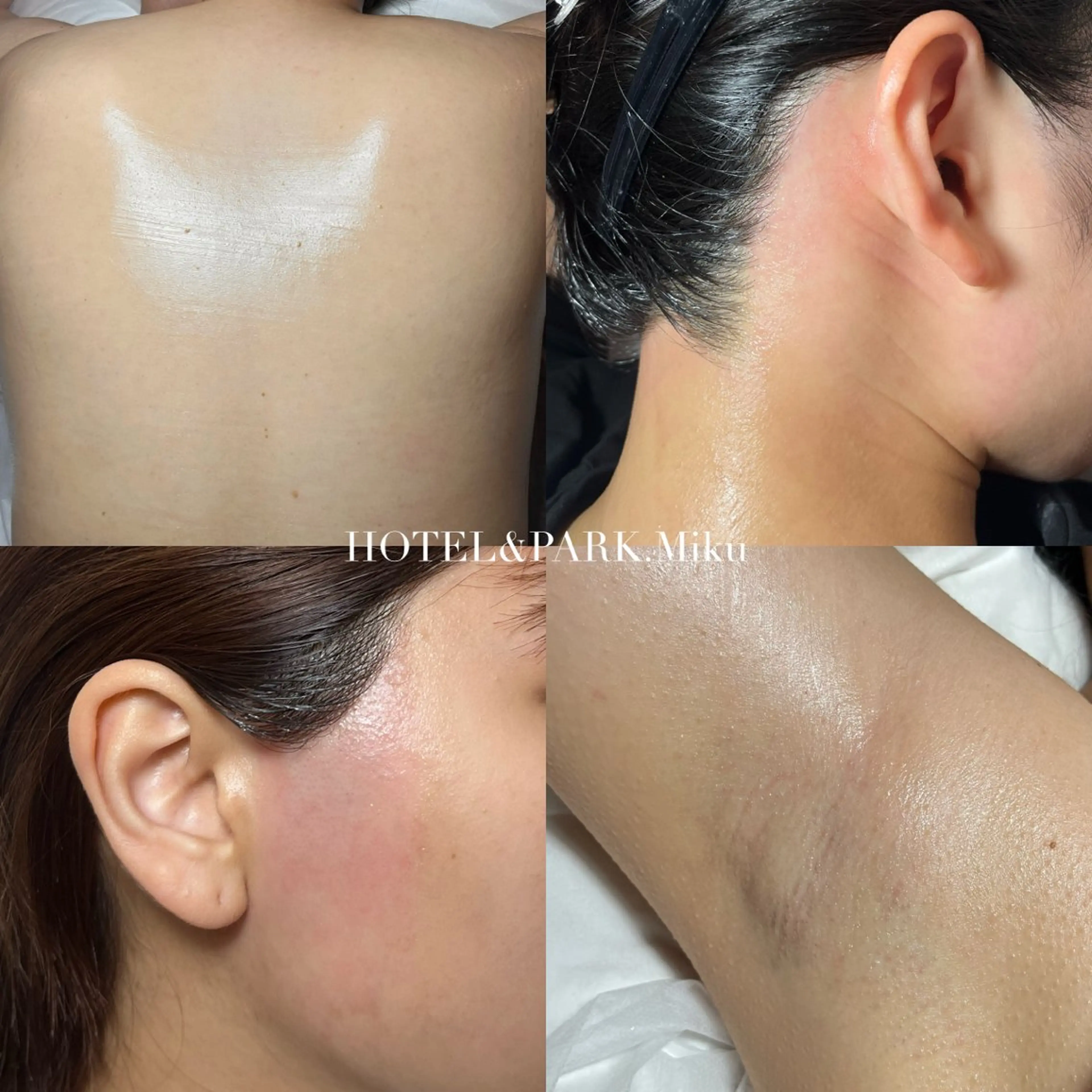 脱毛 HOTEL&PARK Mikuワックス脱毛のエステ・リラクイメージ