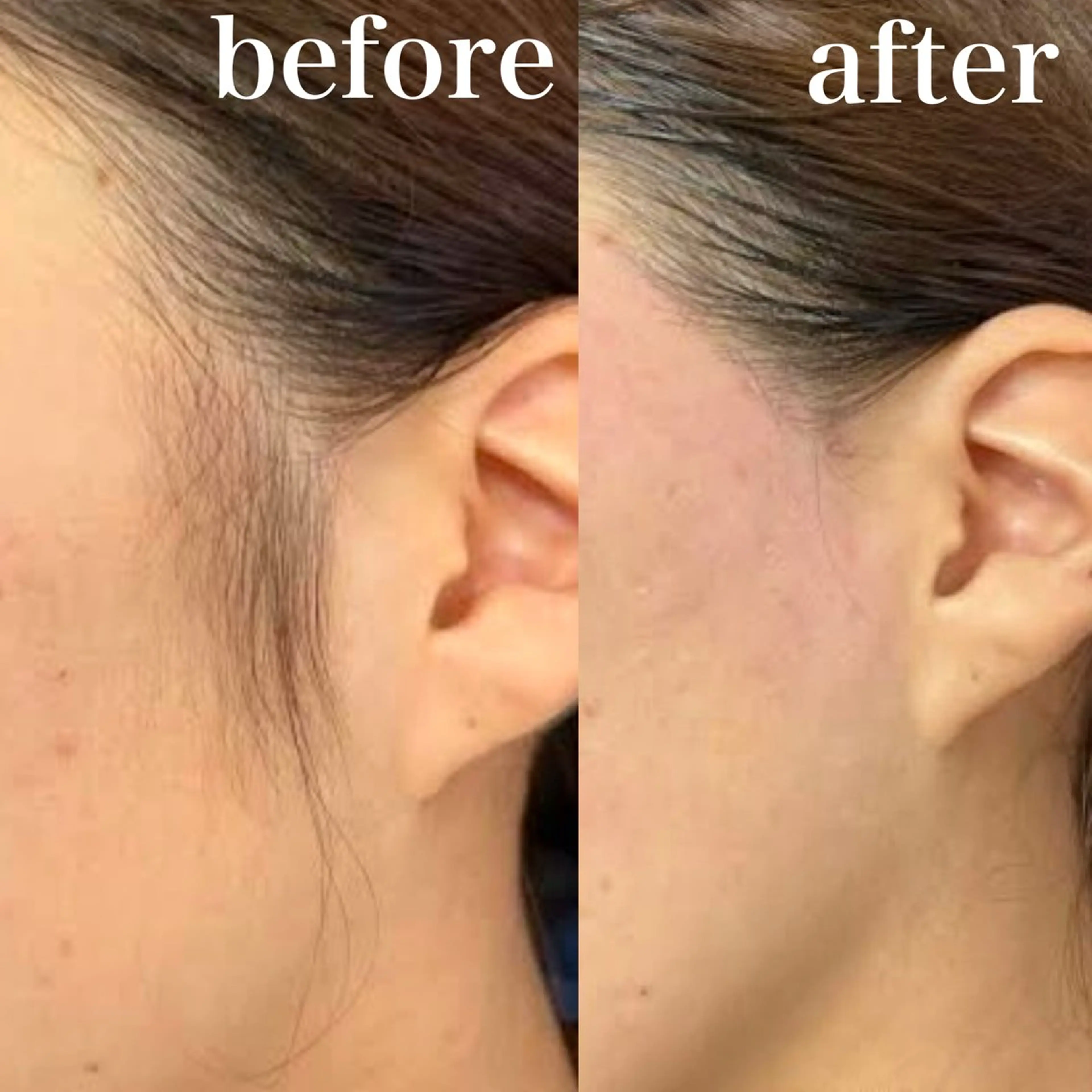 bijou eyesalonのマツエク・マツパデザイン