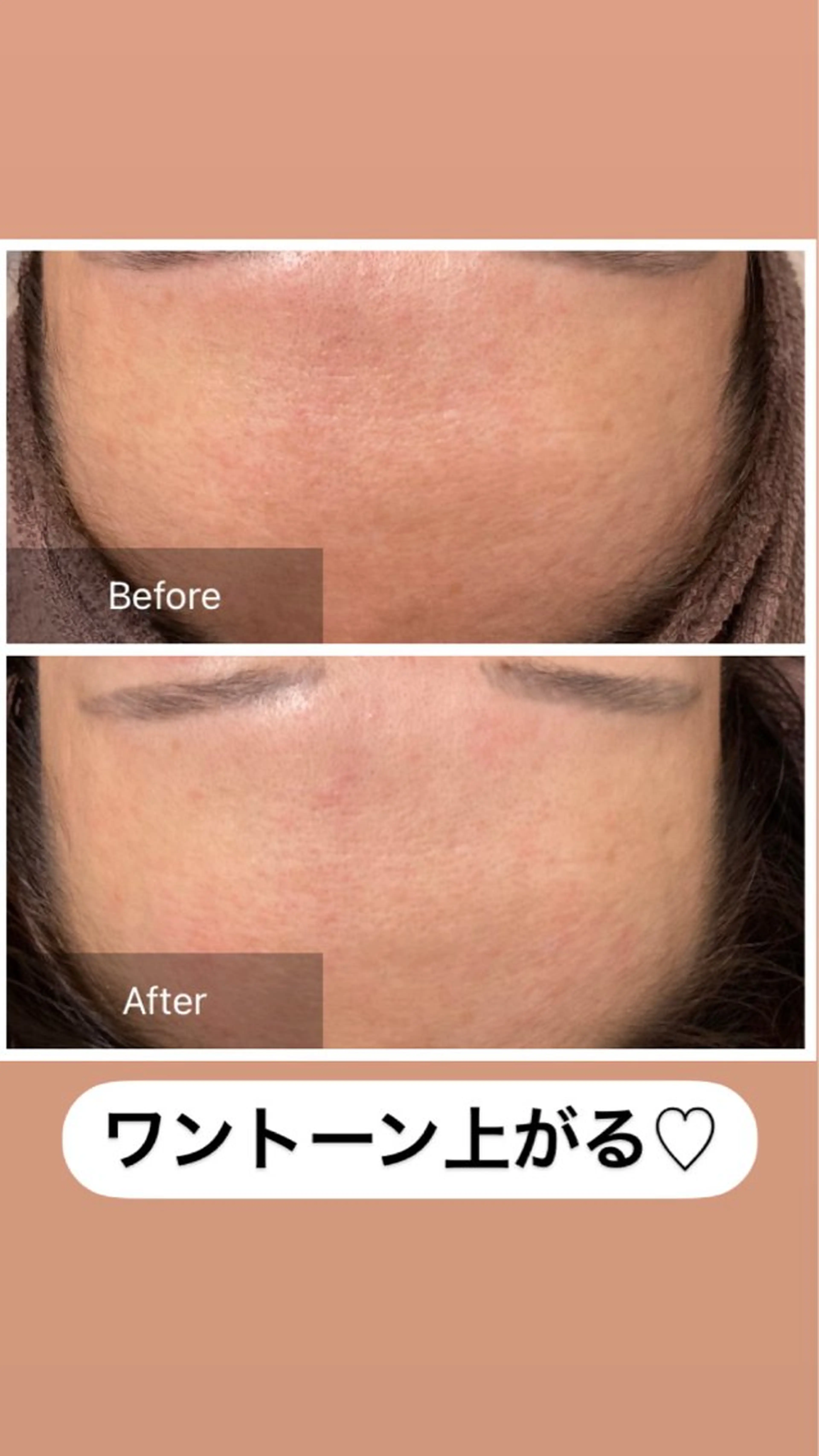 エステ 産毛専門店 Bittoのエステ・リラクイメージ