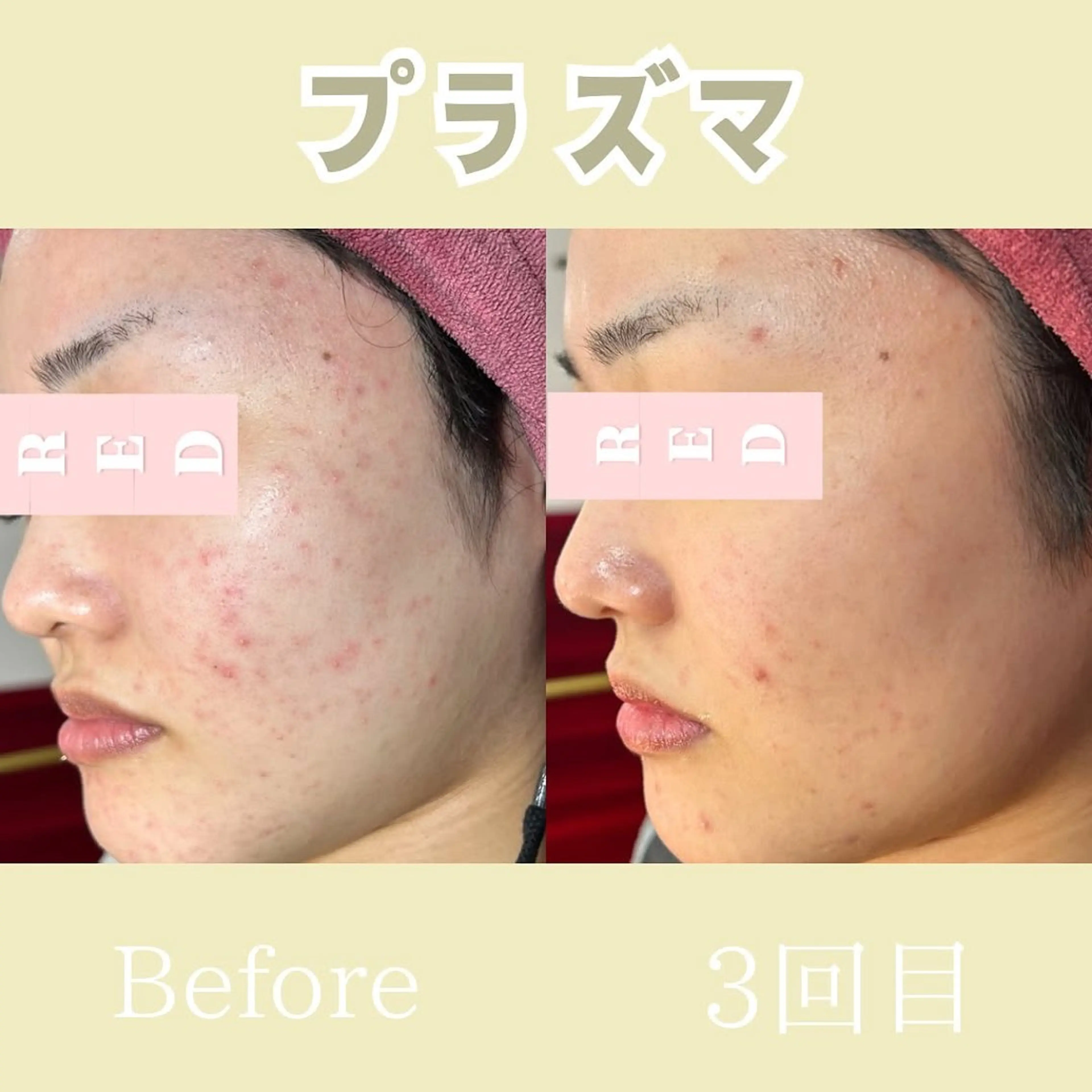 エステ 小顔矯正専門店 【RED】池田のエステ・リラクイメージ