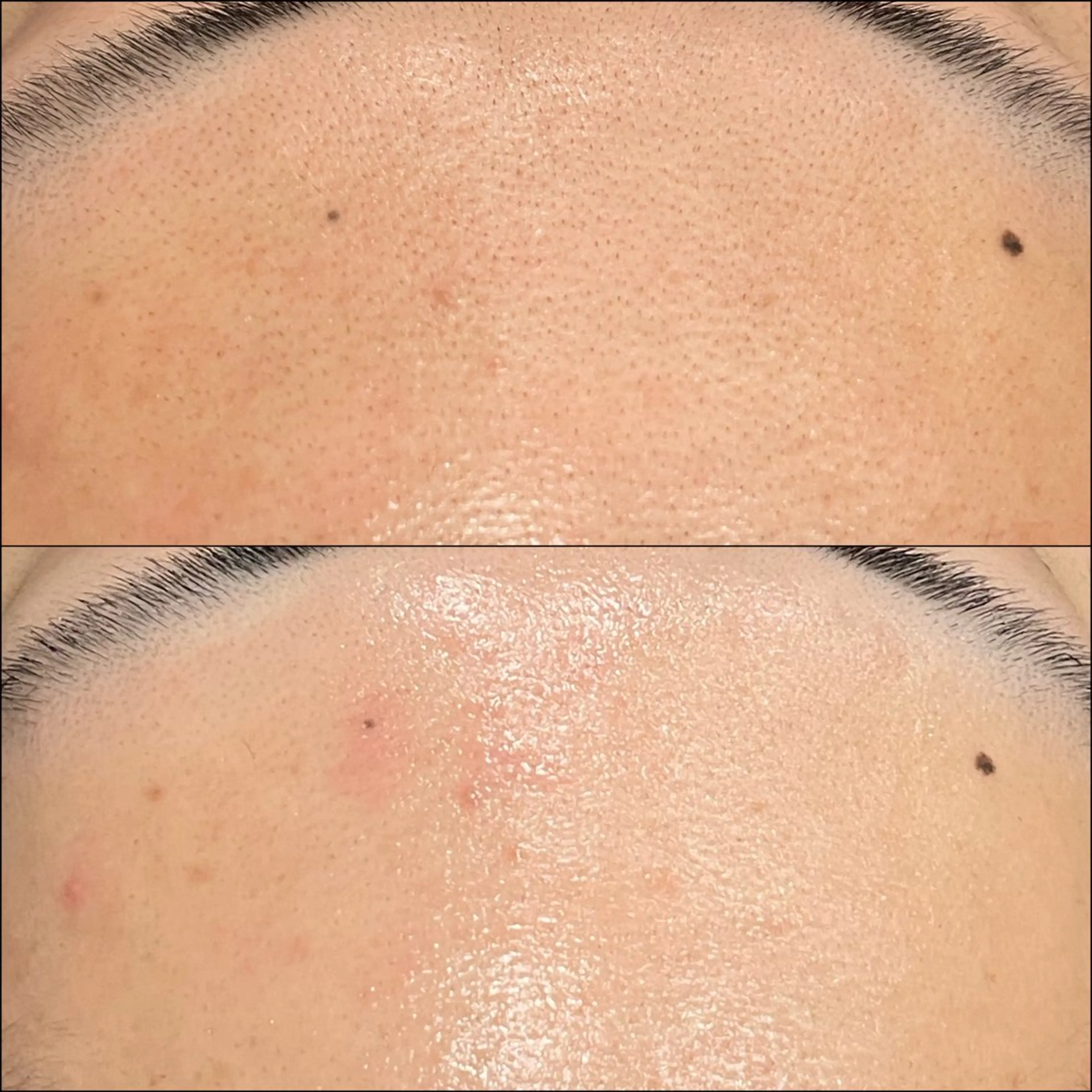 脱毛 LiZA エステティックサロンのエステ・リラクイメージ