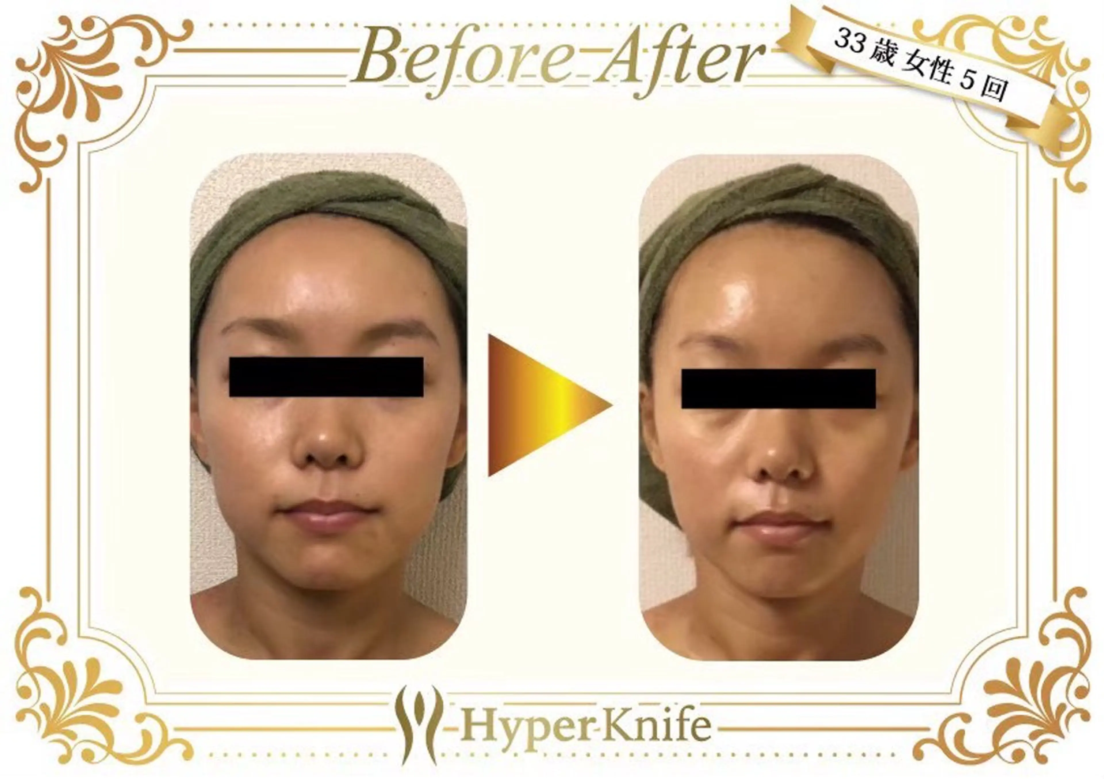 美癒 ハイパーナイフ&アロマ所属・美癒 池袋東口店のエステ・リラクイメージ