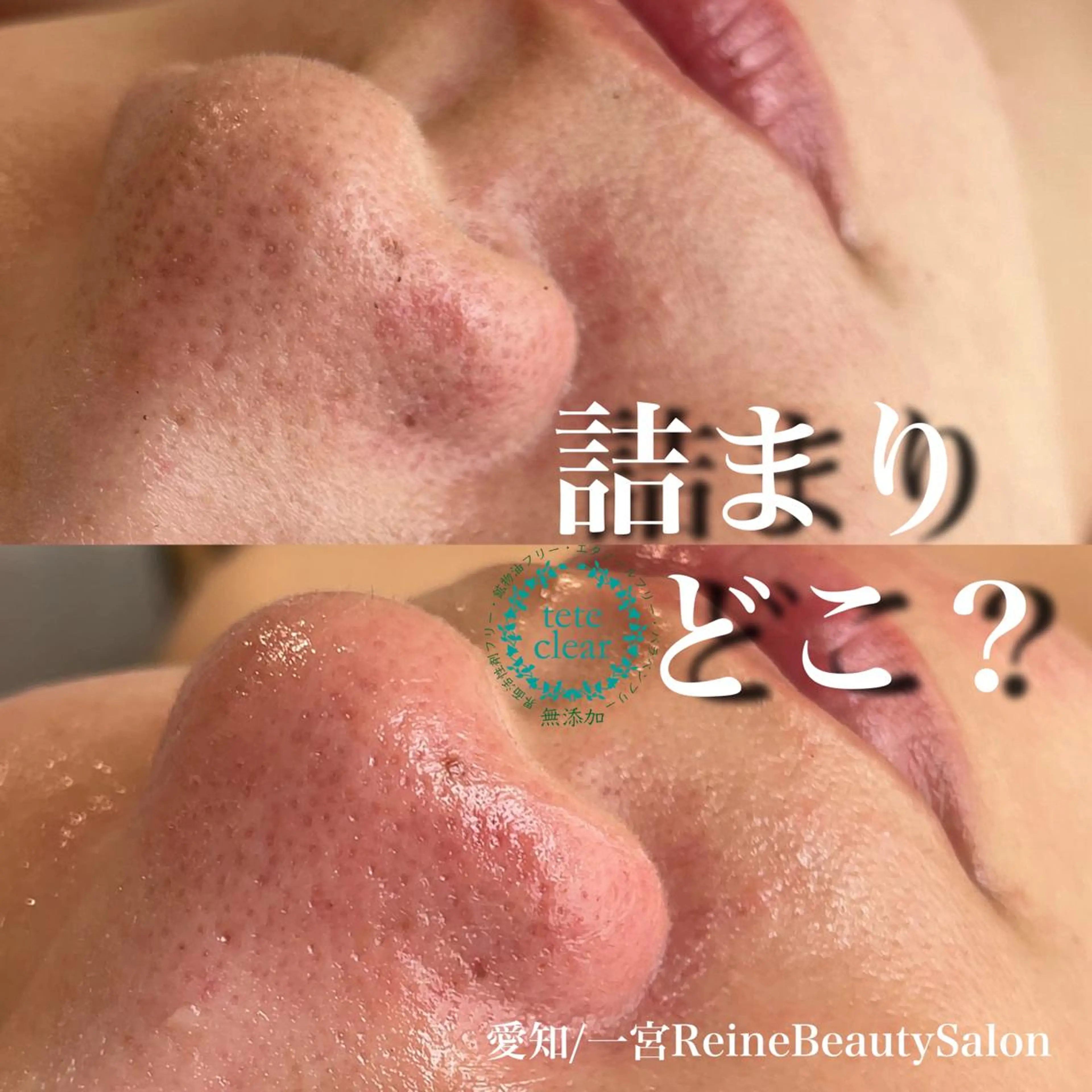 エステ Reine BeautySalon所属・毛穴/シミ肝斑/脱毛 横山梨里のエステ・リラクイメージ