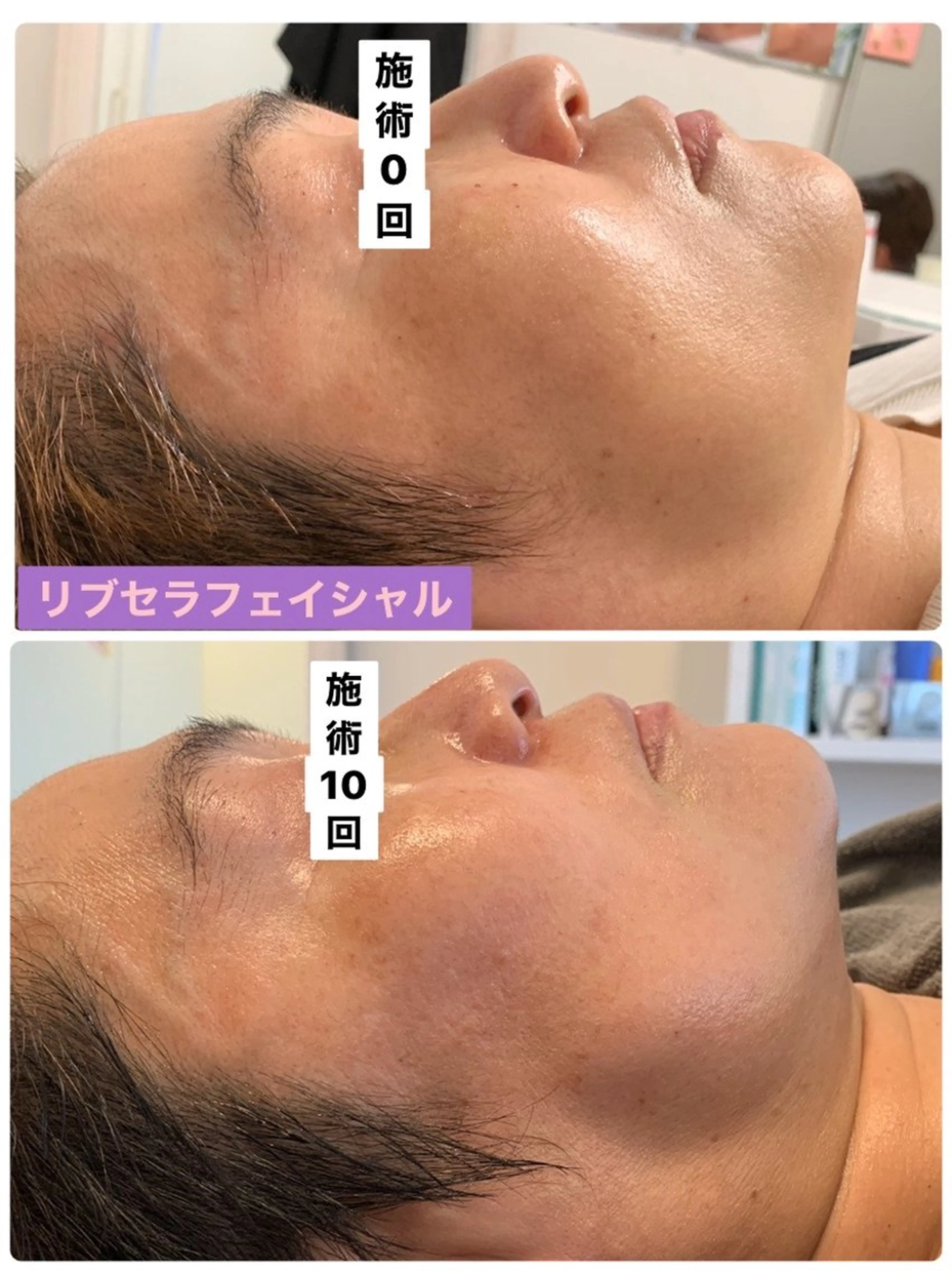 エステ Private Salon Prunelle所属・プライベートサロン プリュネルのエステ・リラクイメージ