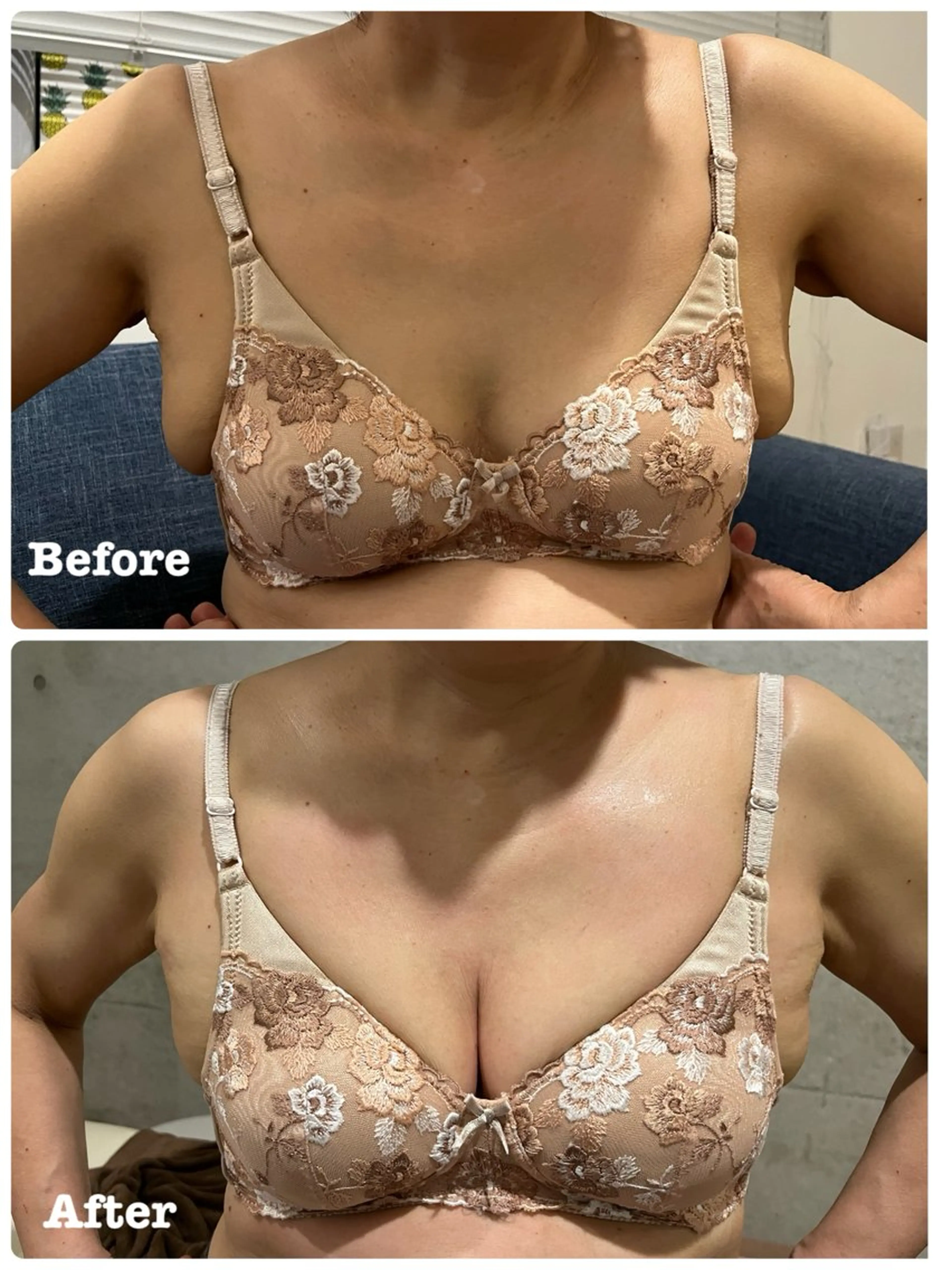 マシュマロバスト　ふっくらバストアップケアの写真