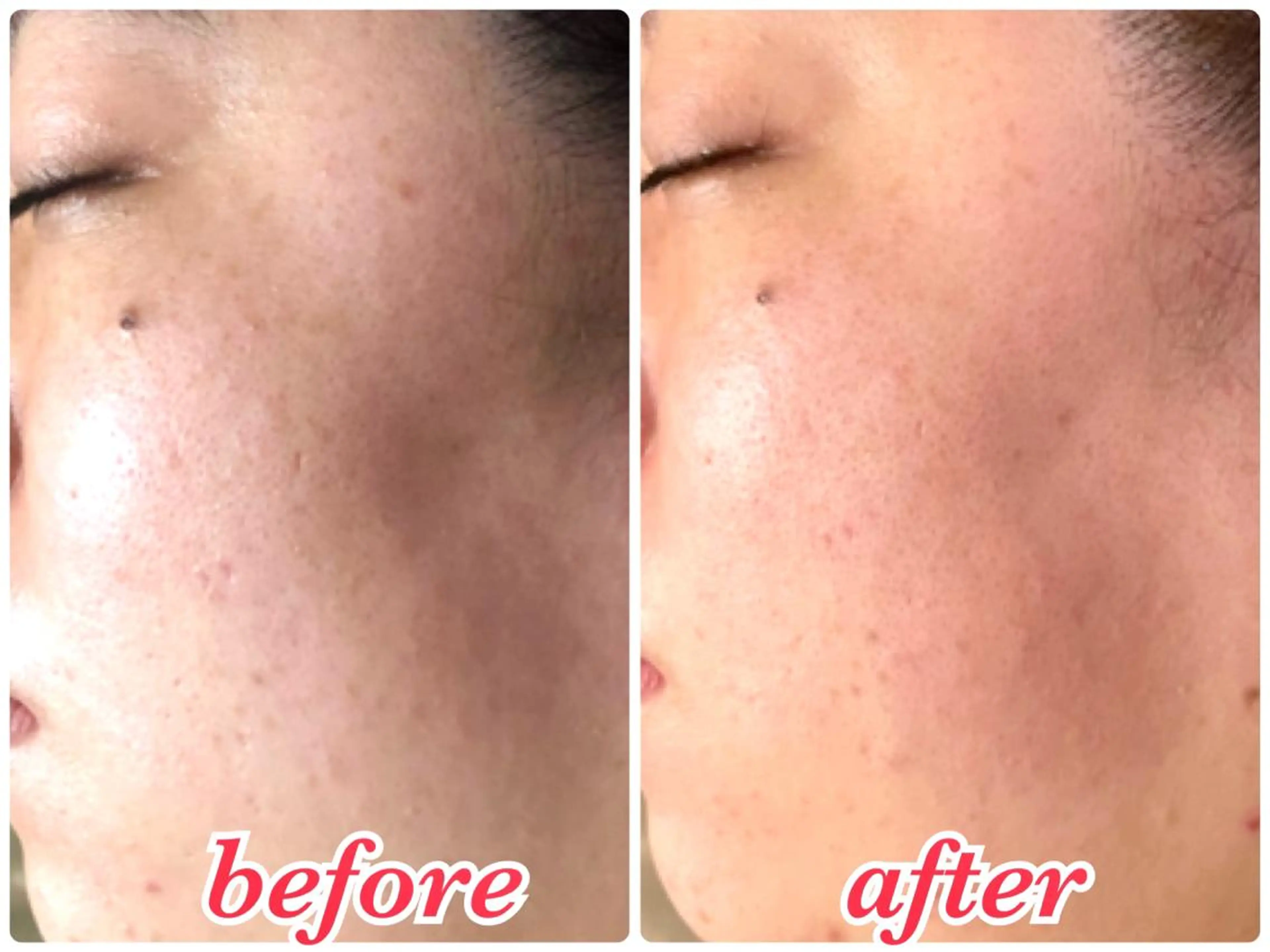 その他 美ola ビオラのエステ・リラクイメージ