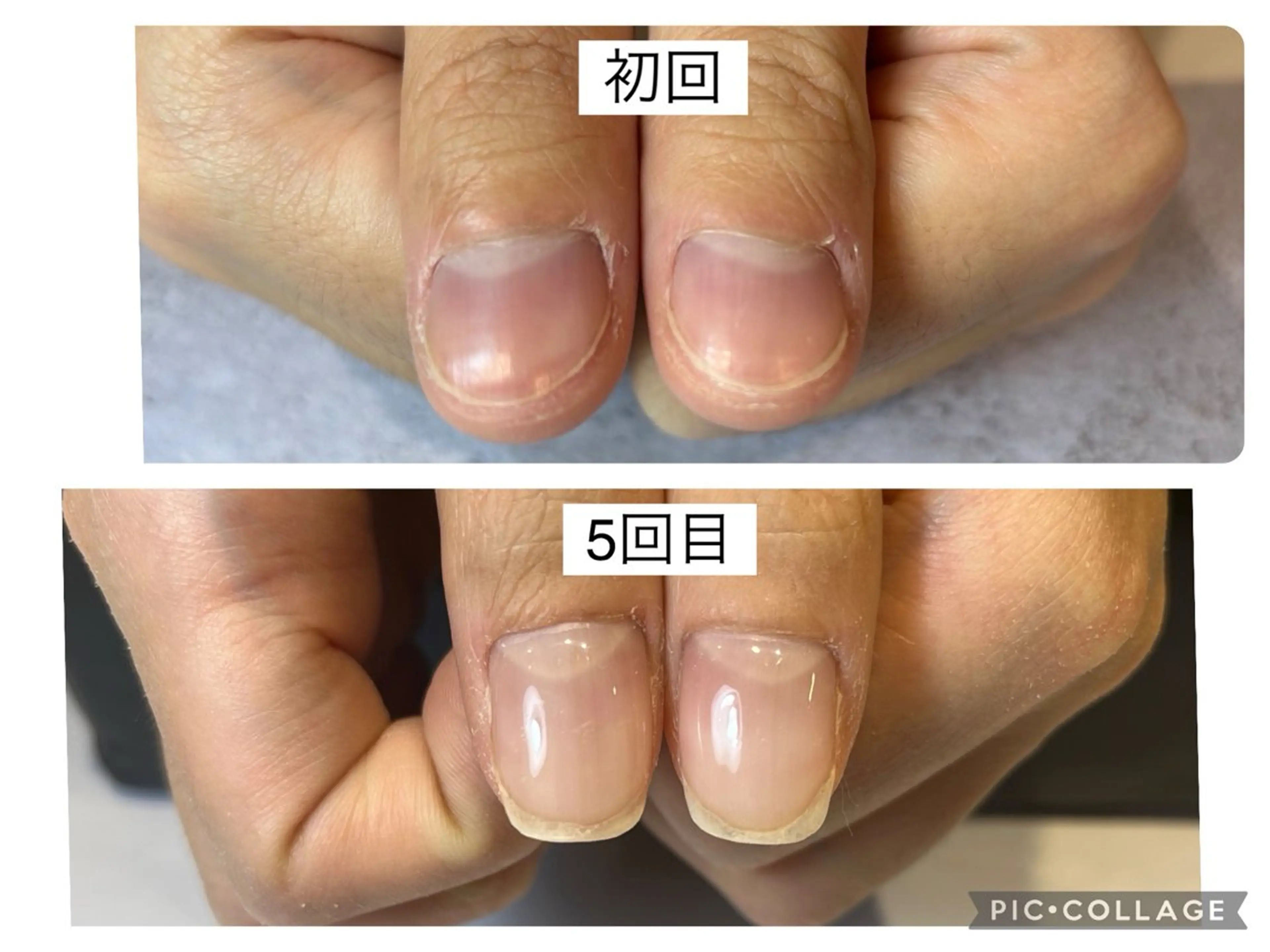 12/13限定！自爪育成ジェルコース（ホームケア付き）の写真