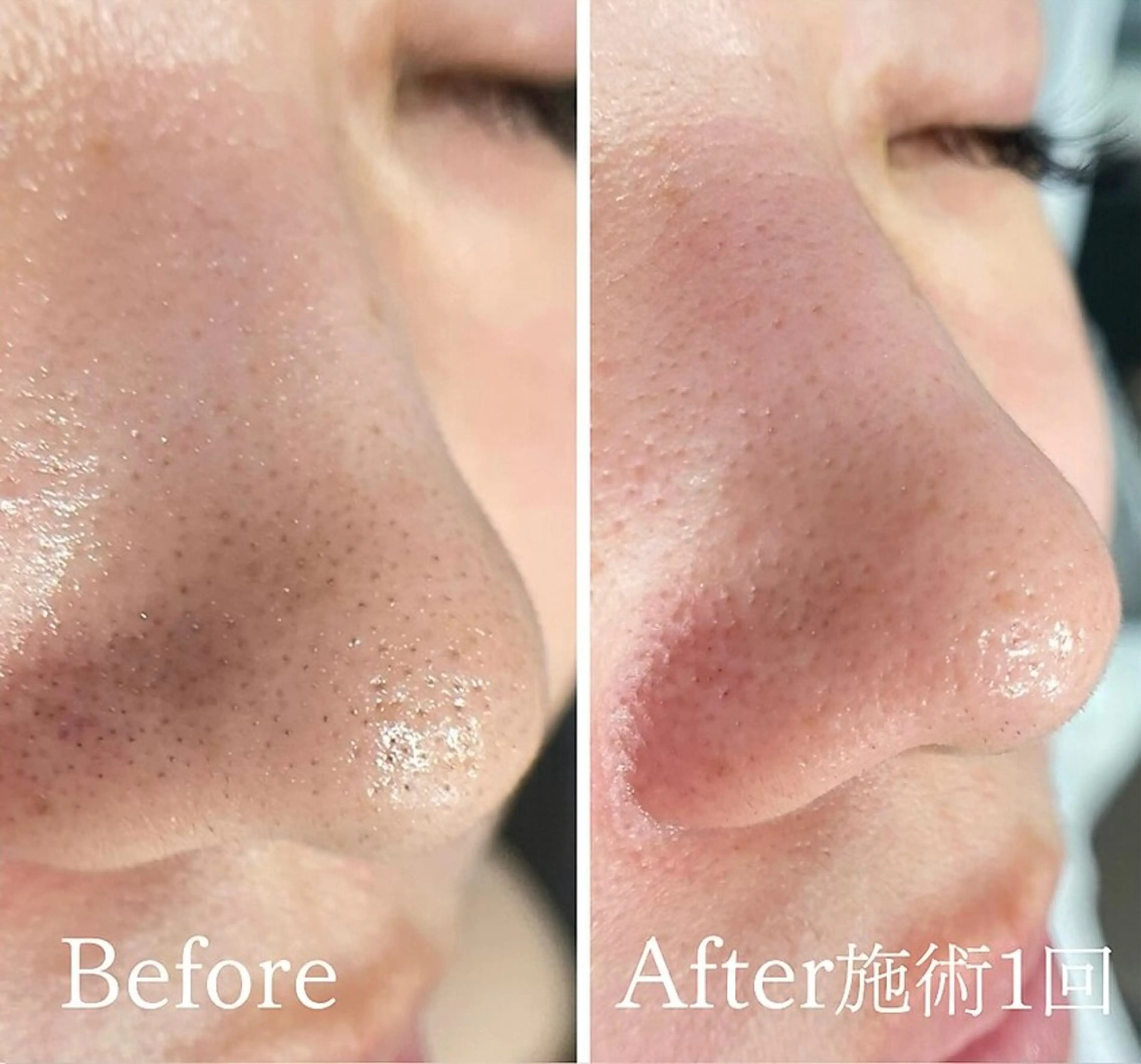 アンド ミルルのエステ・リラクイメージ