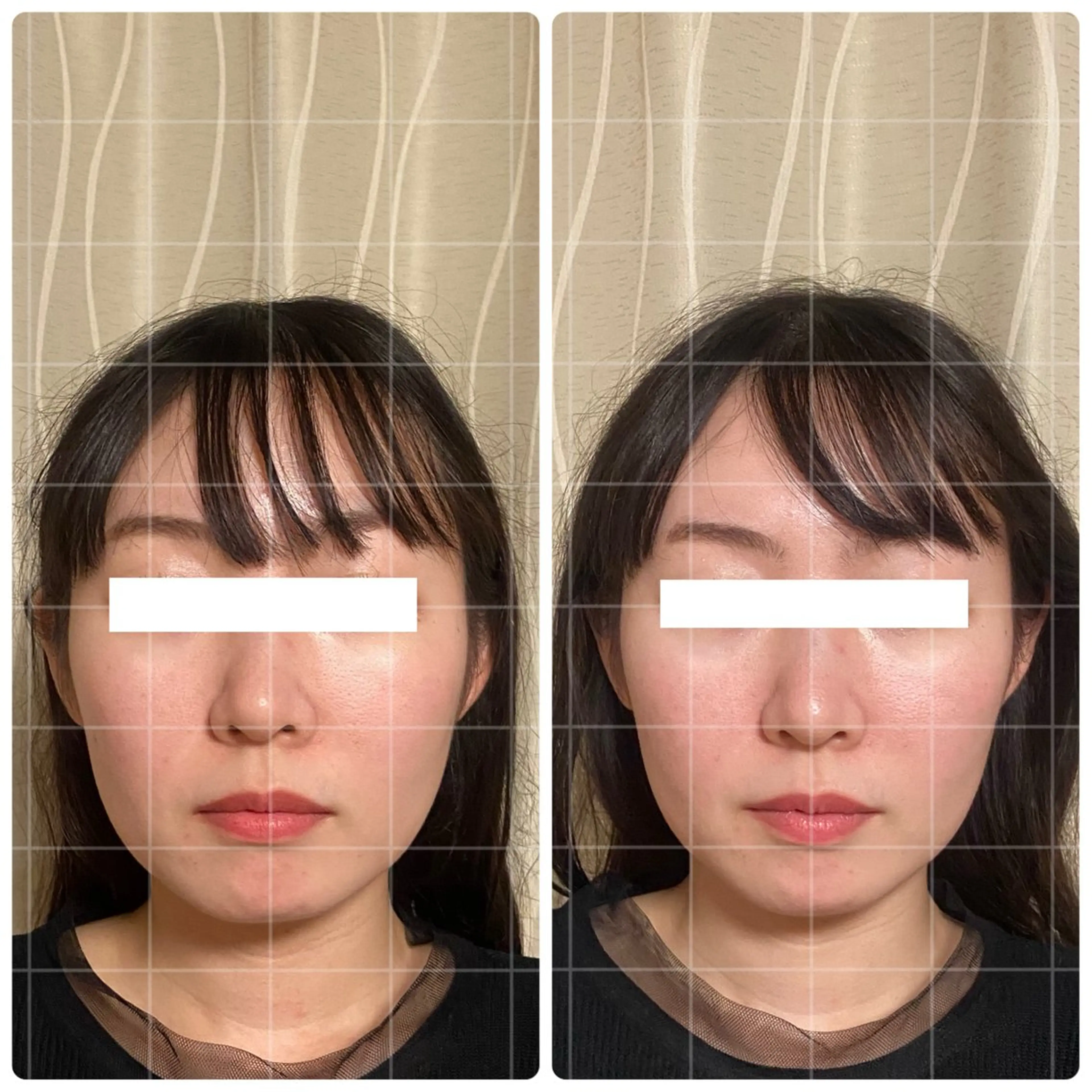 くつろぎ小顔サロン Lu mellow所属・片山けいこ｜ 美人顔創りの専門家のエステ・リラクイメージ