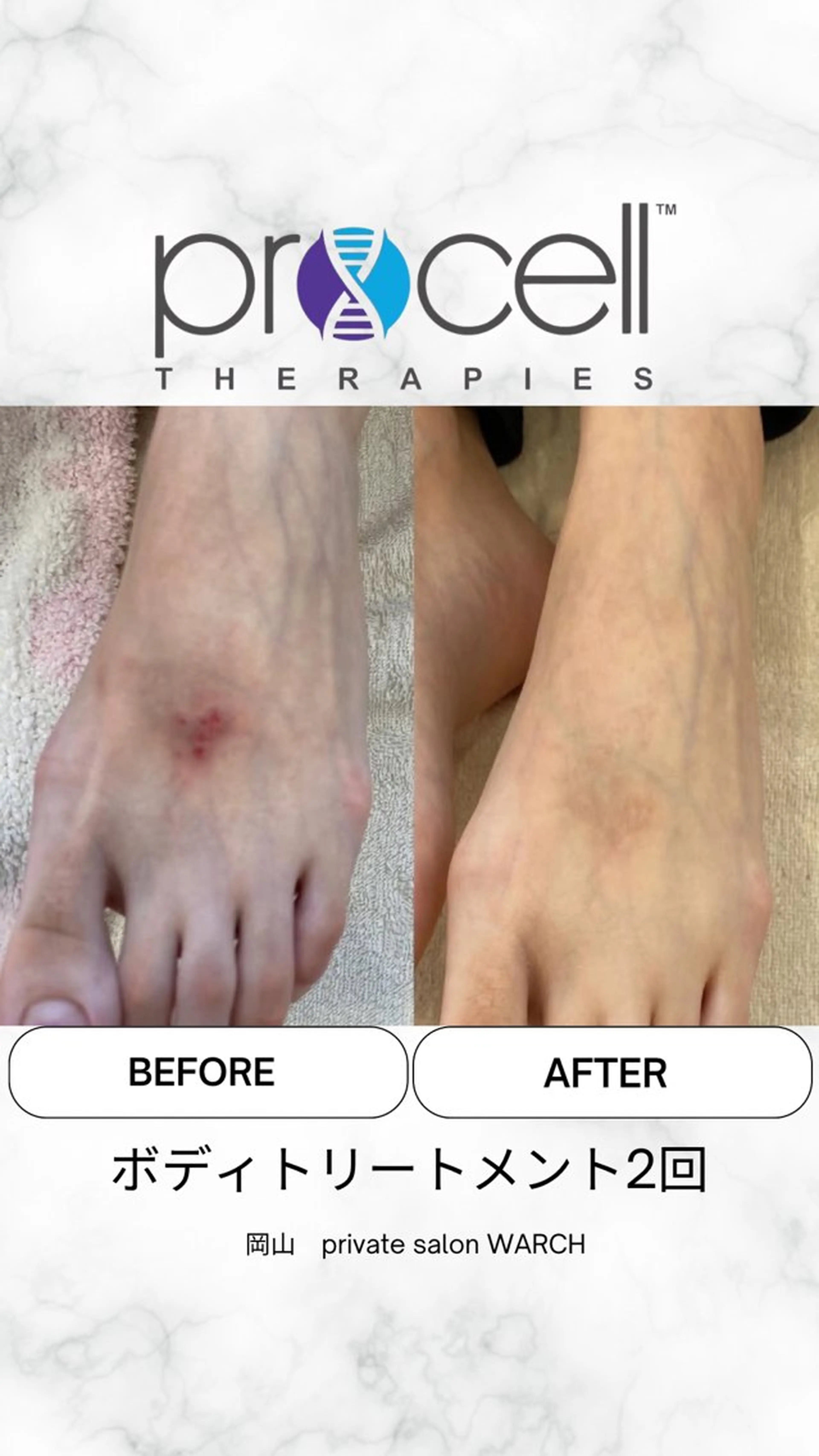 WARCH Marieのその他イメージ