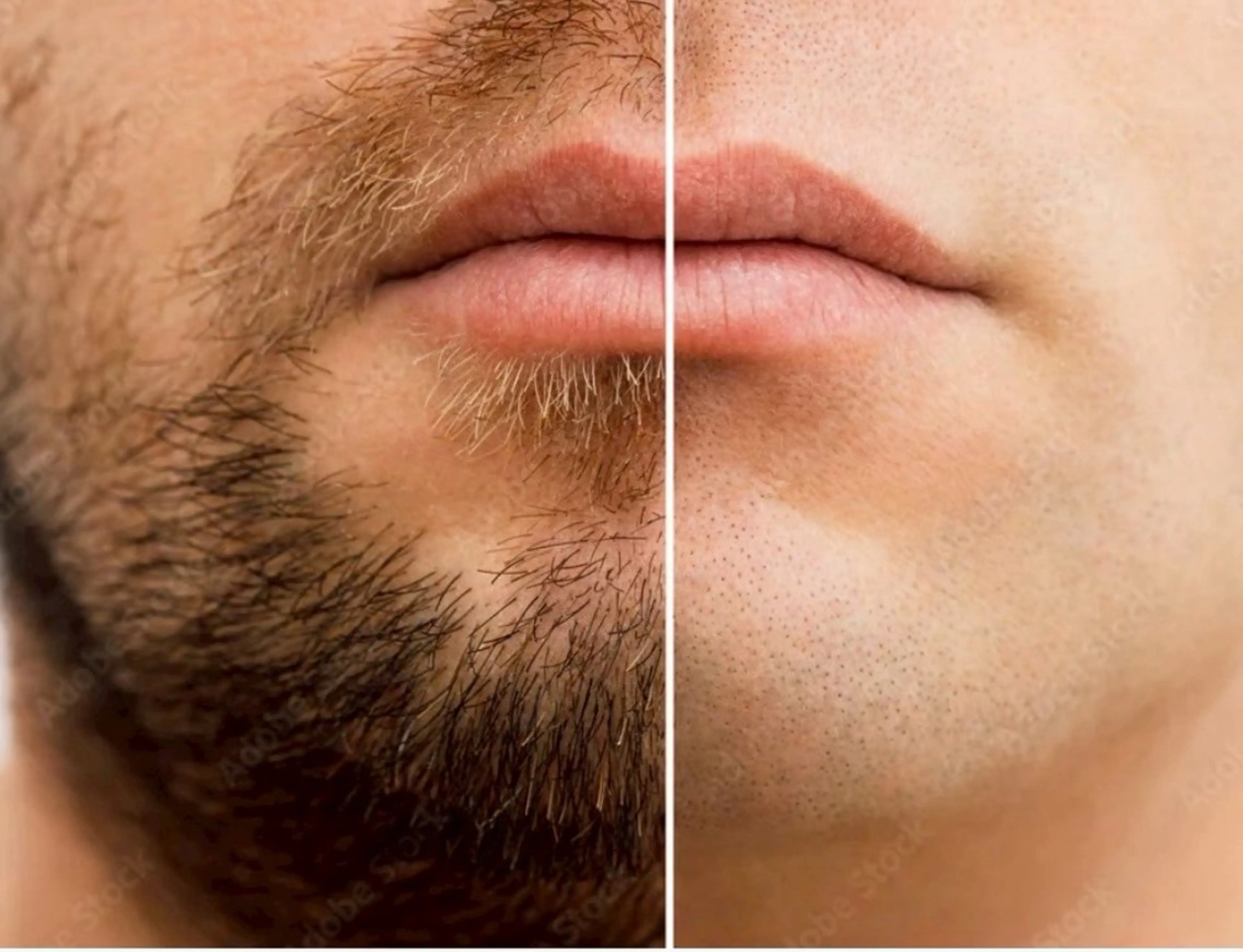 メンズ 脱毛 Prima栄店所属・Prima 〜プリマ栄店〜のエステ・リラクイメージ