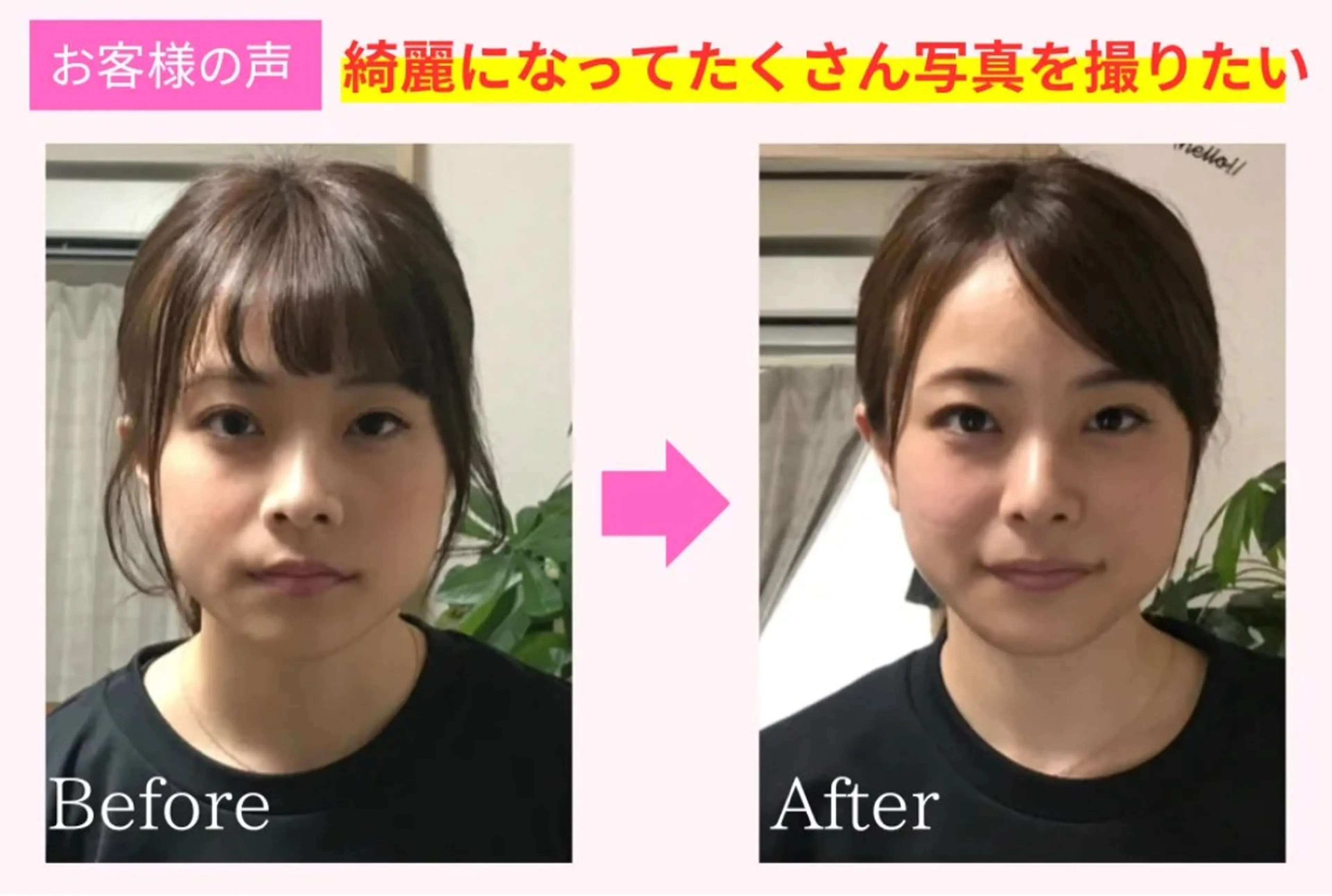 小顔矯正【たるみ改善・法令線・エラ・左右差】頭蓋骨から根本的に整える整体の写真