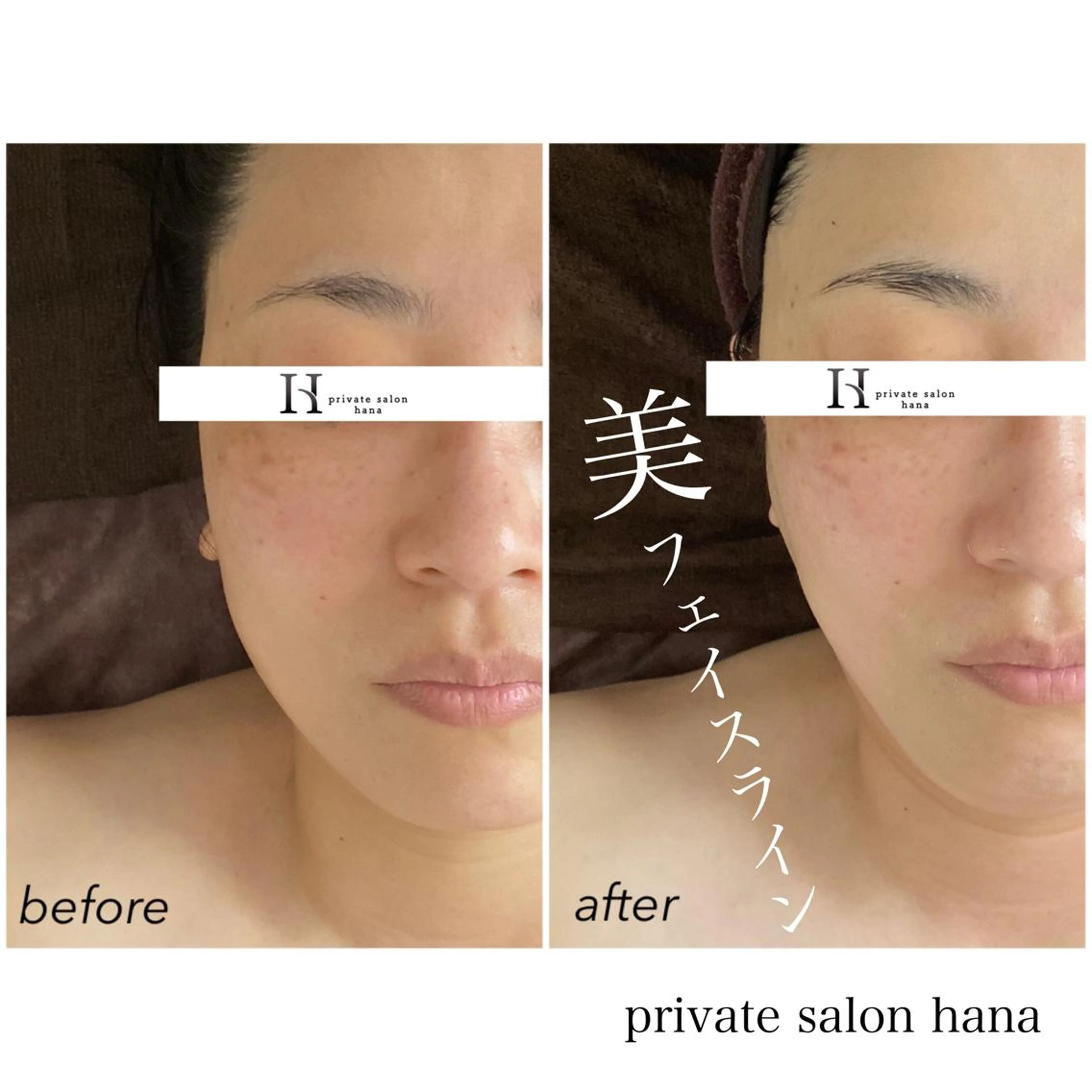 エステ リラク private salon hanaのエステ・リラクイメージ