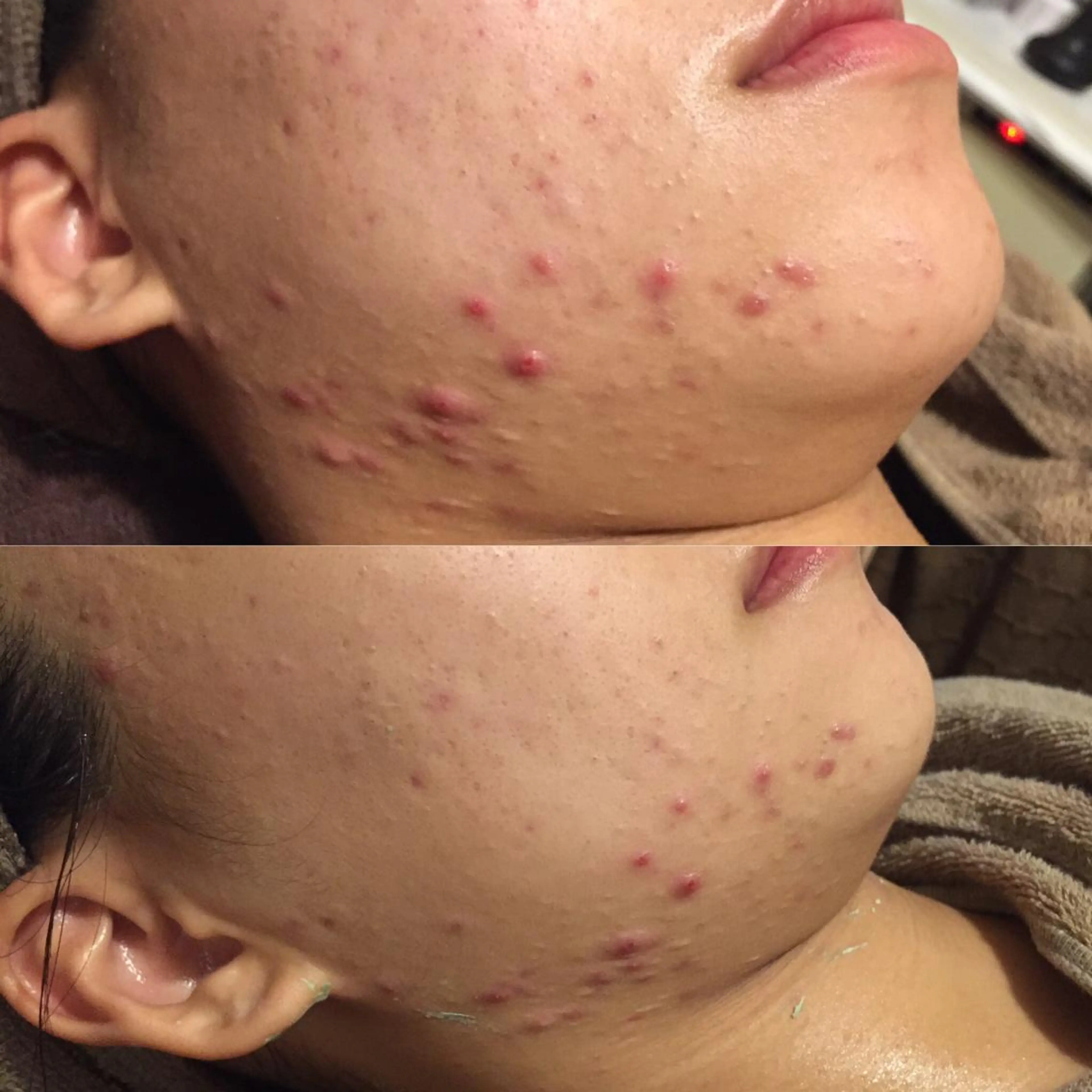 ビューティーサロン　サランブル所属・肌質改善エステサロン サランブルのエステ・リラクイメージ