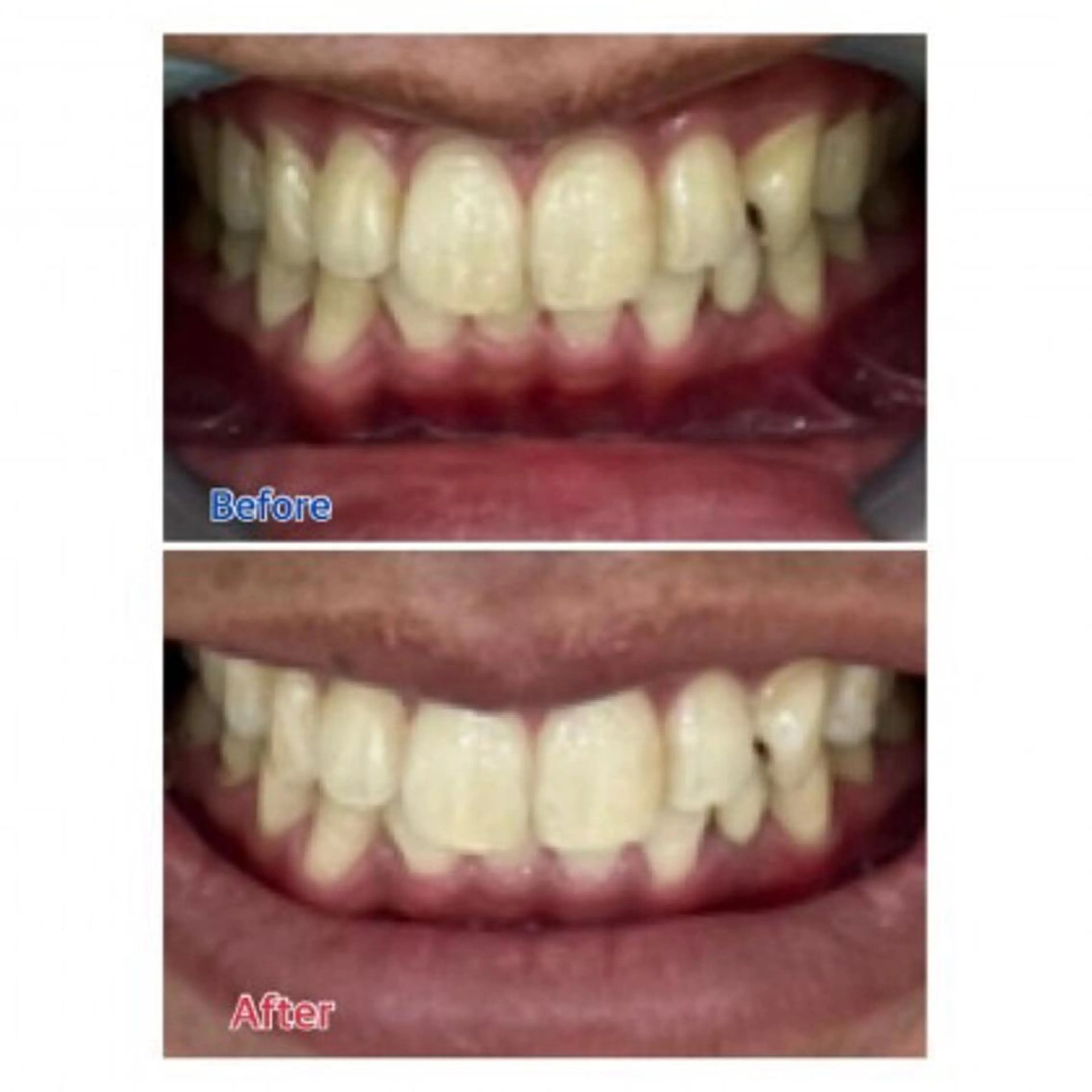 M渋谷店所属・Ｍ渋谷 ホワイトニングのエステ・リラクイメージ