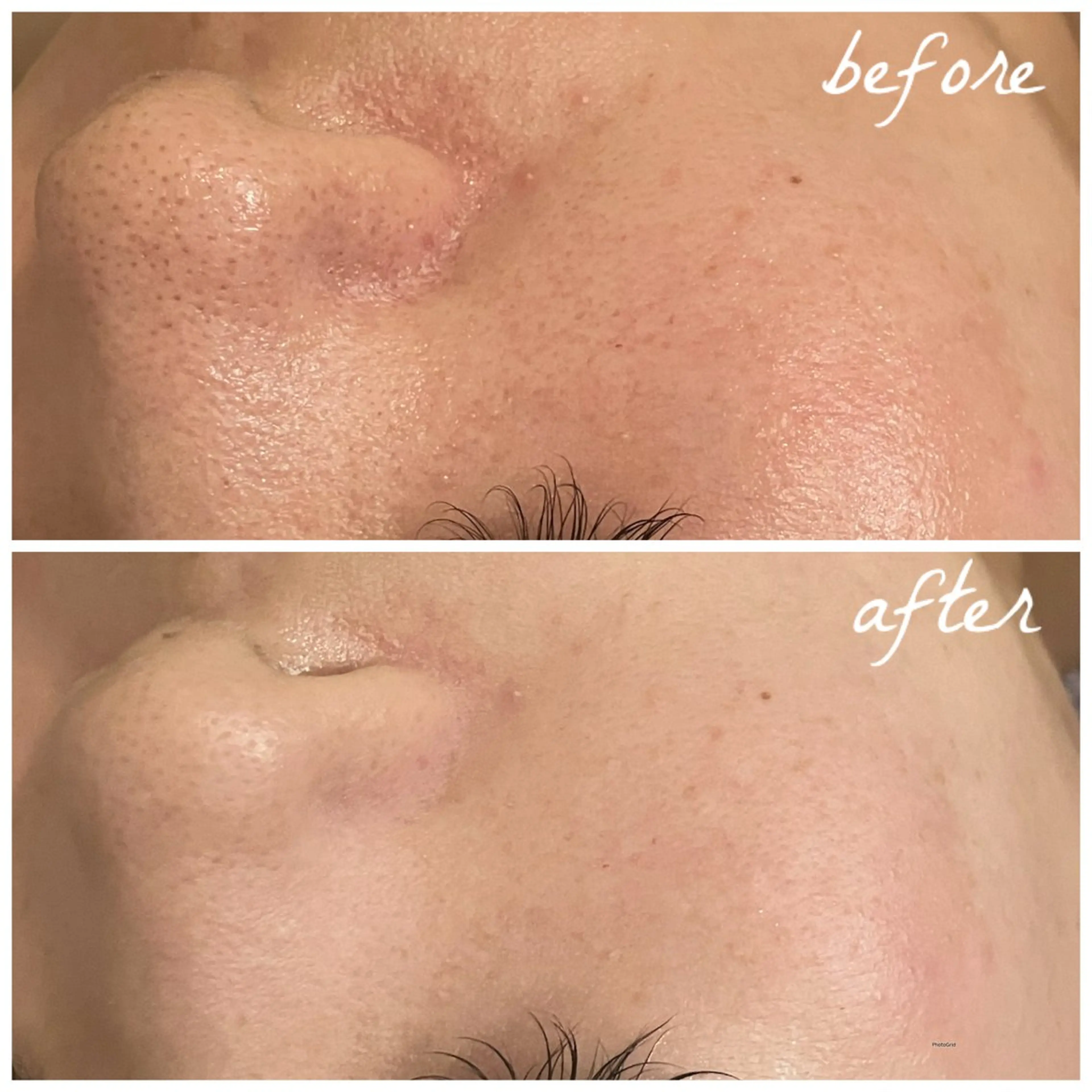 メンズ エステ メナード岐阜茜部 杉浦のエステ・リラクイメージ