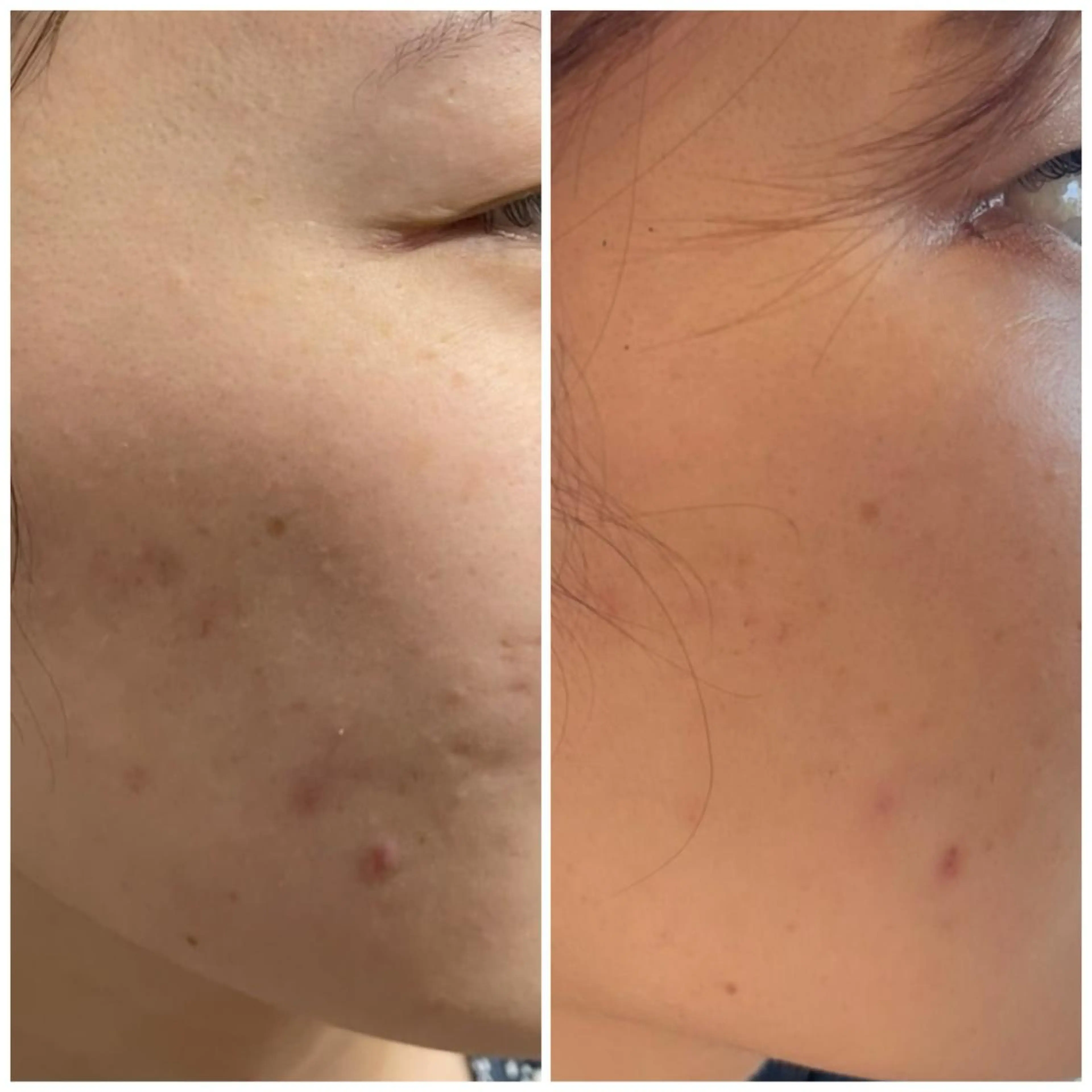 mignon /栄のエステ・リラクイメージ