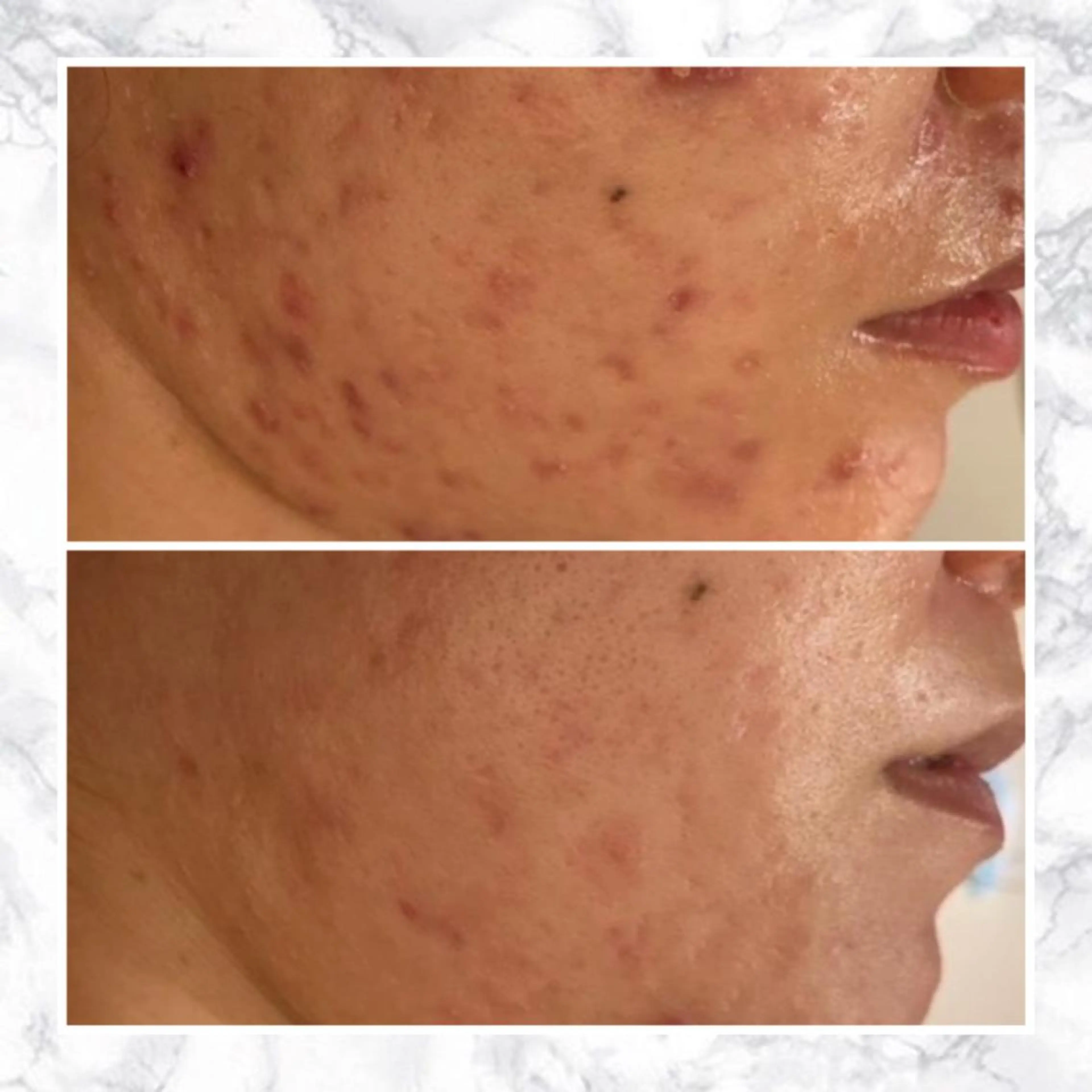 触れたくなる モテ肌へ...❤︎のエステ・リラクイメージ