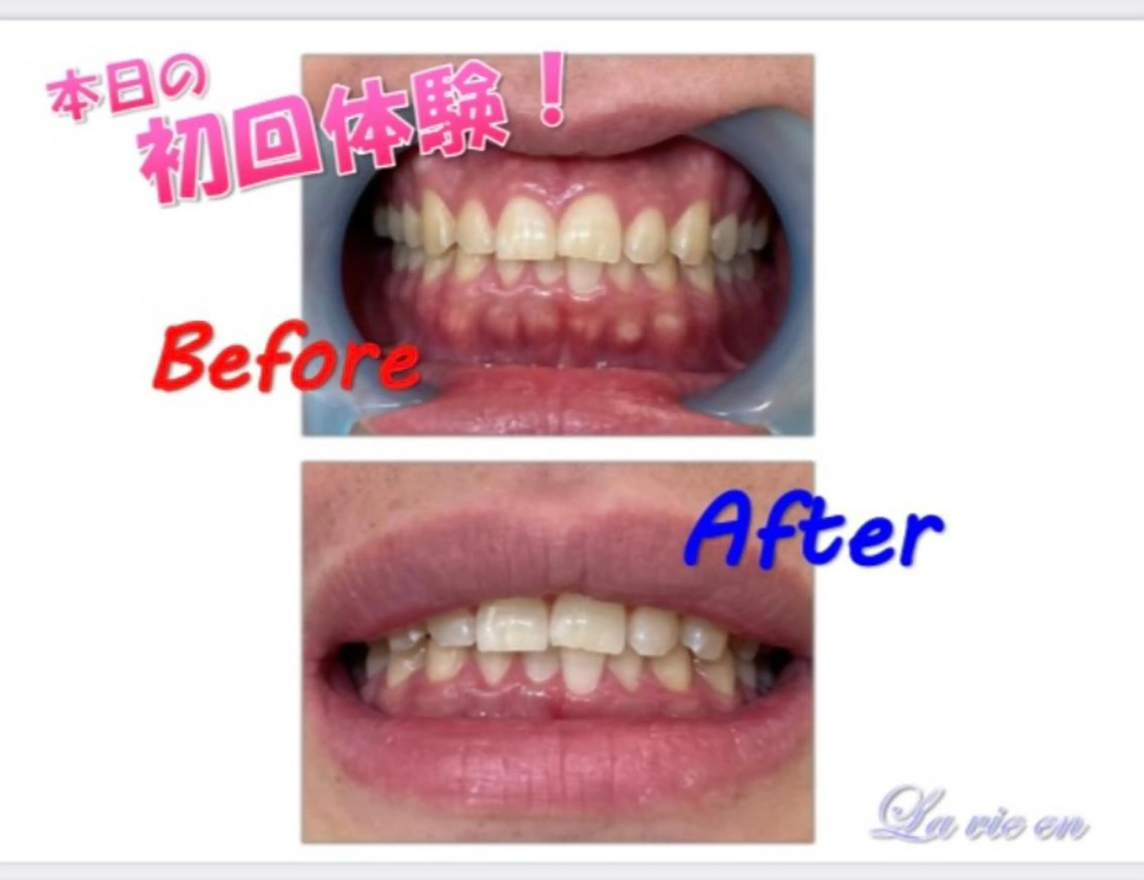 その他 セルフホワイトニングサロン　ラヴィアン所属・ホワイトニングサロン La vie enのその他イメージ