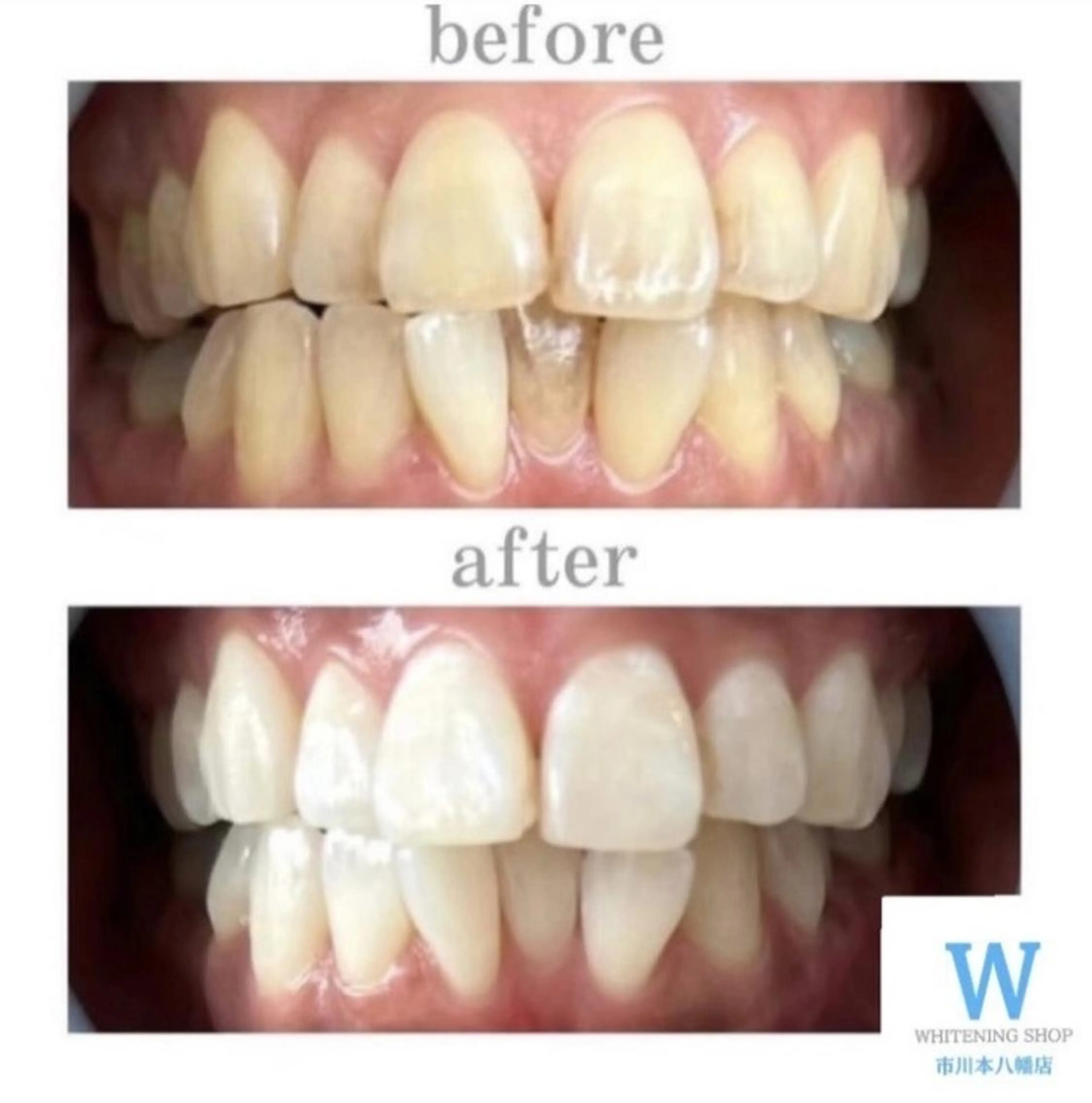 ホワイトニング ショップ本八幡店のエステ・リラクイメージ