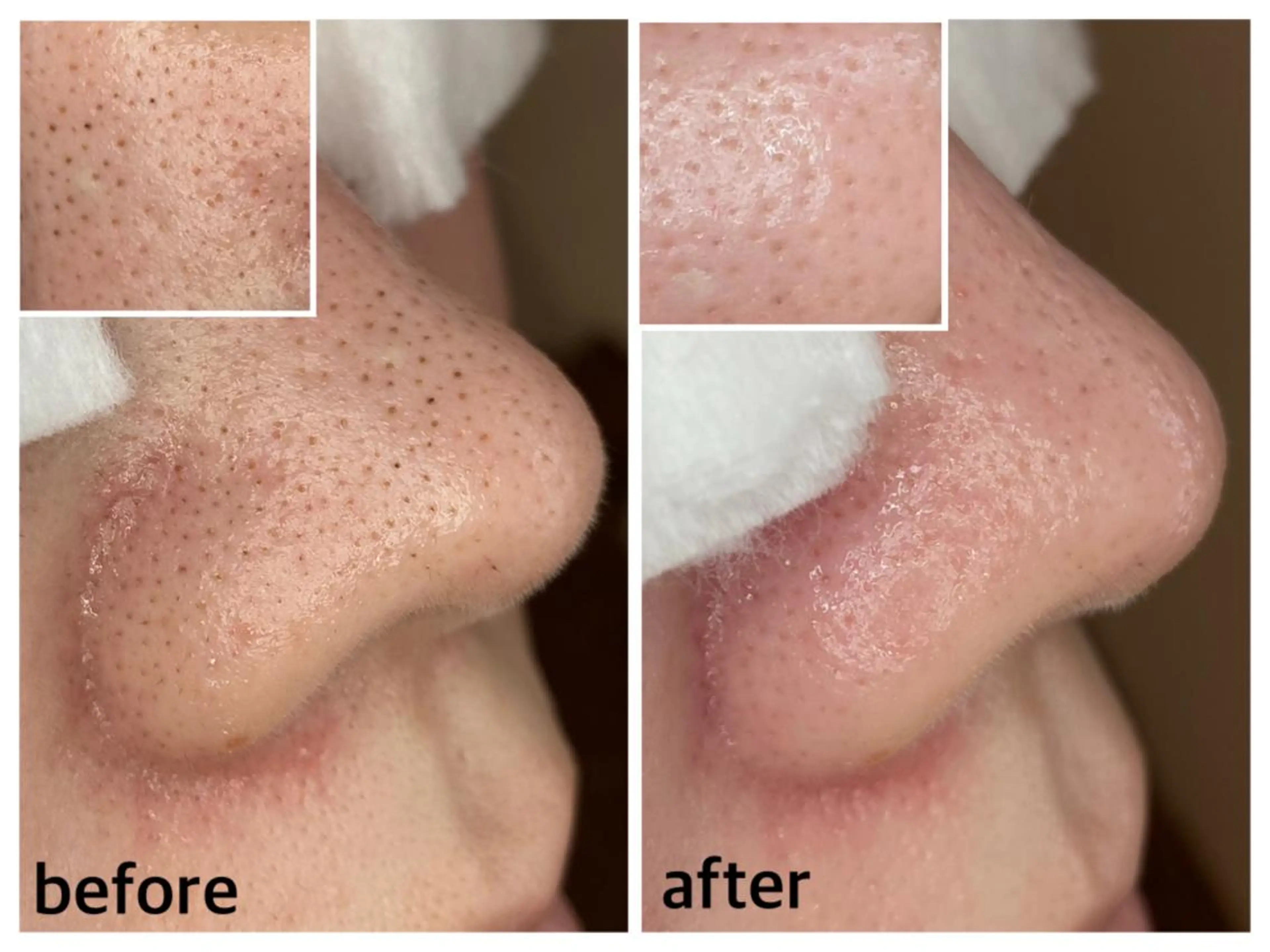 韓国肌管理 【毛穴専科】のエステ・リラクイメージ