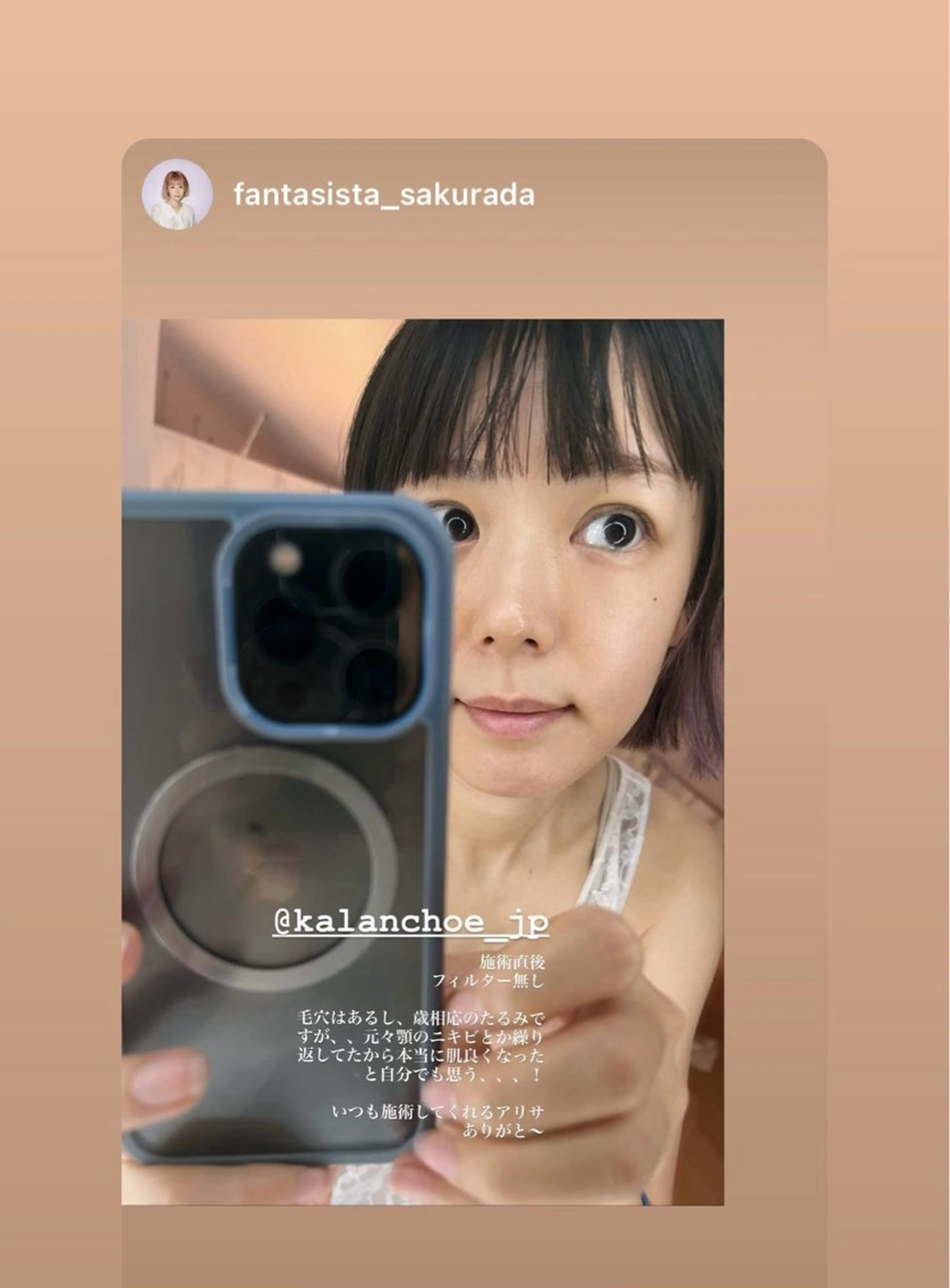 エステ 肌質改善 KALANCHOEのエステ・リラクイメージ