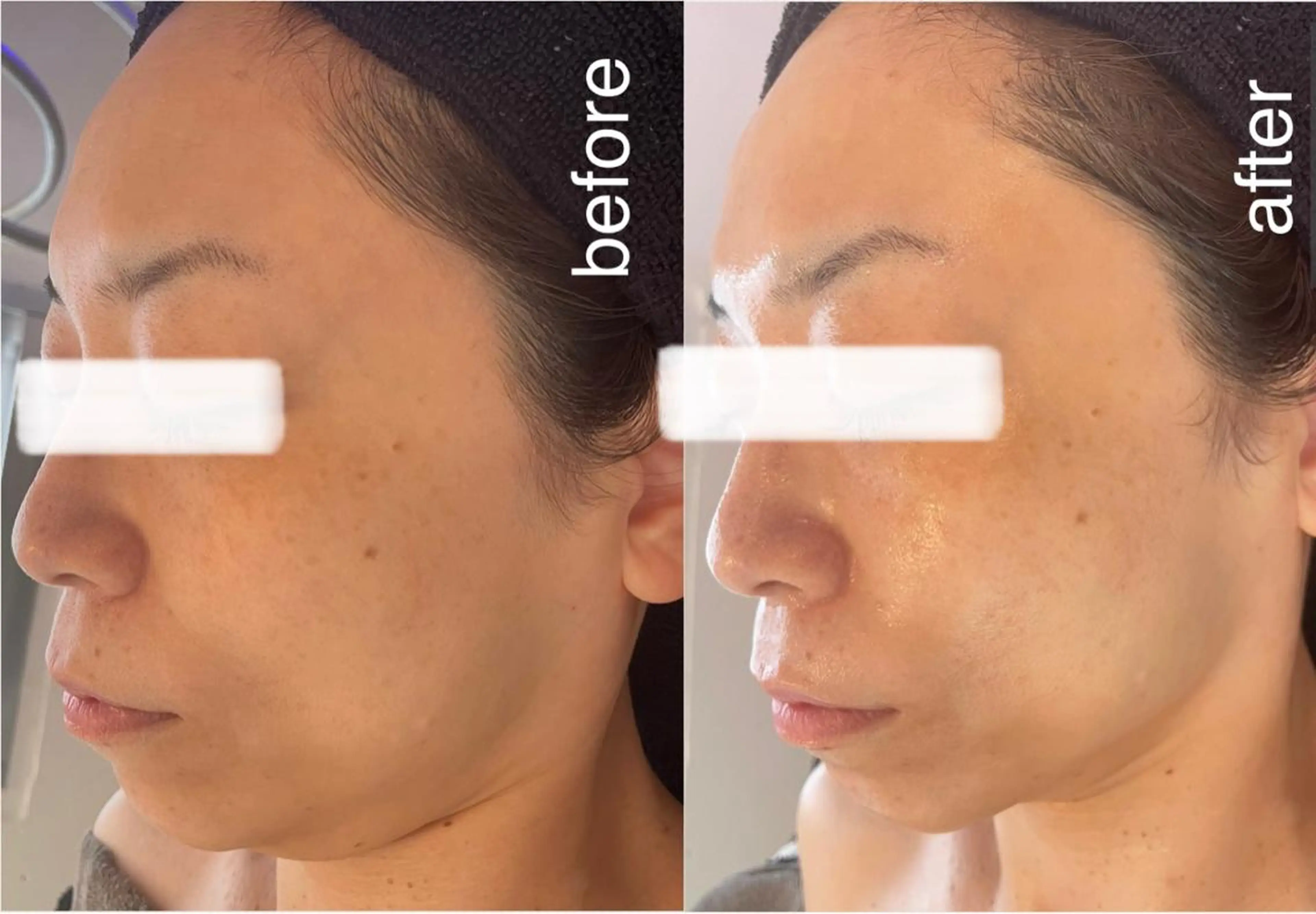 エステ Lavi&所属・肌質改善サロン Lavi&のその他イメージ