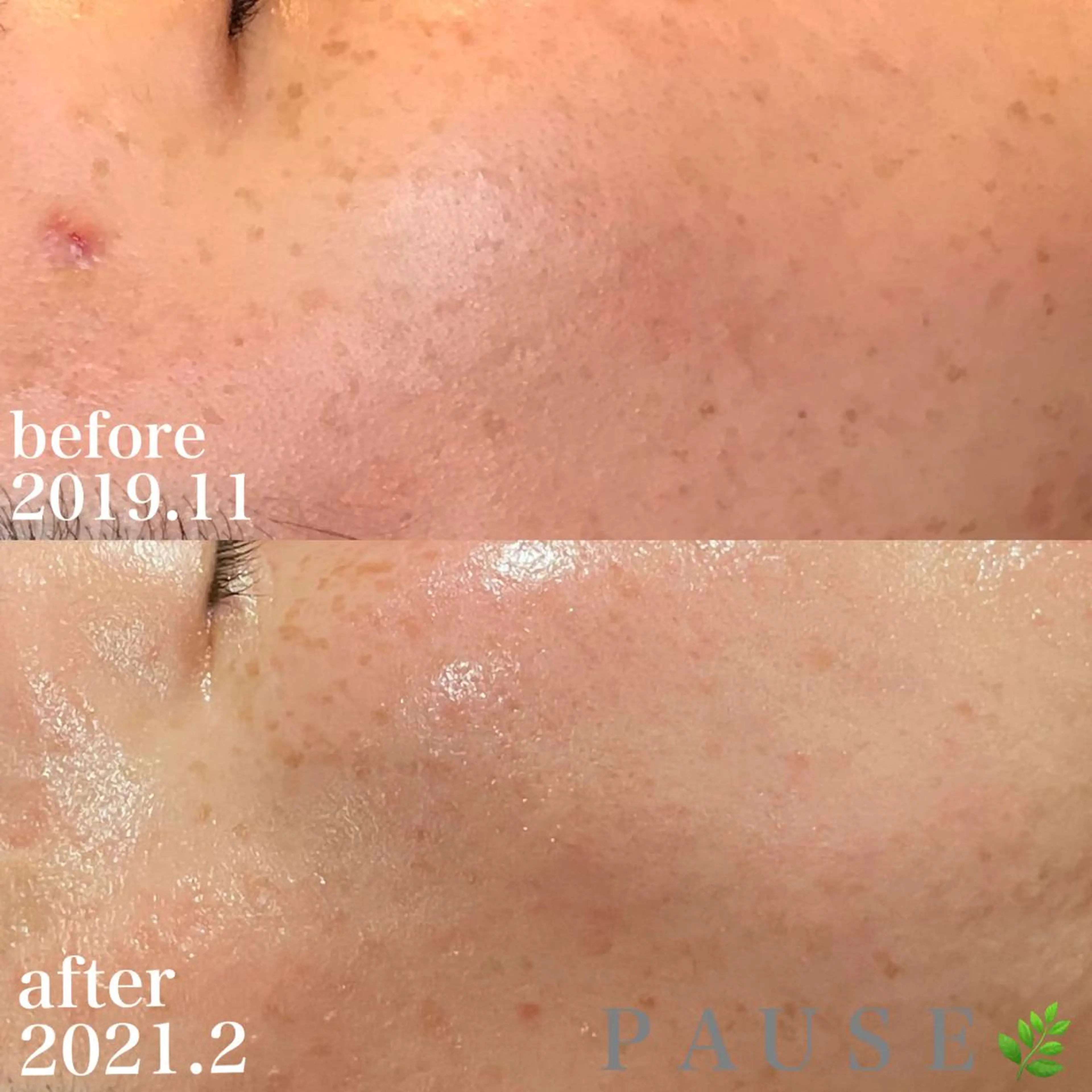 エステ 浜野 恵美のエステ・リラクイメージ