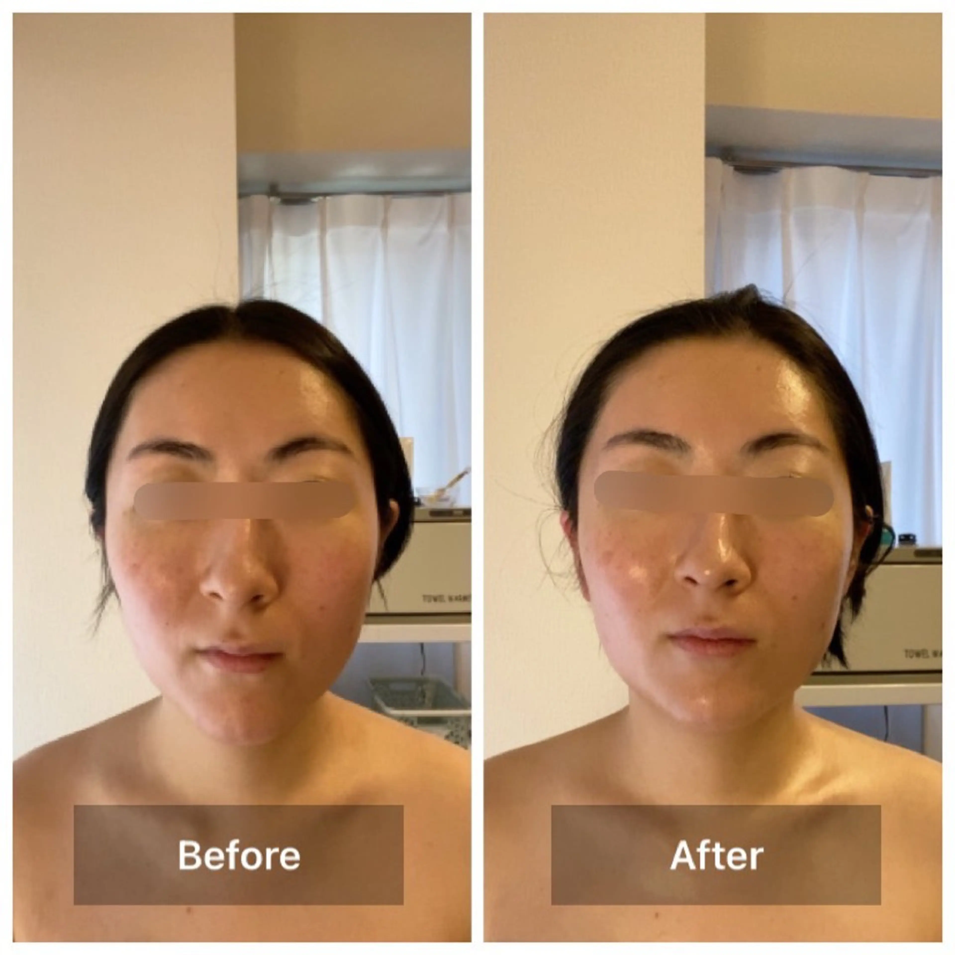 エステ 眉毛×小顔矯正サロン パピヨンsakiのエステ・リラクイメージ