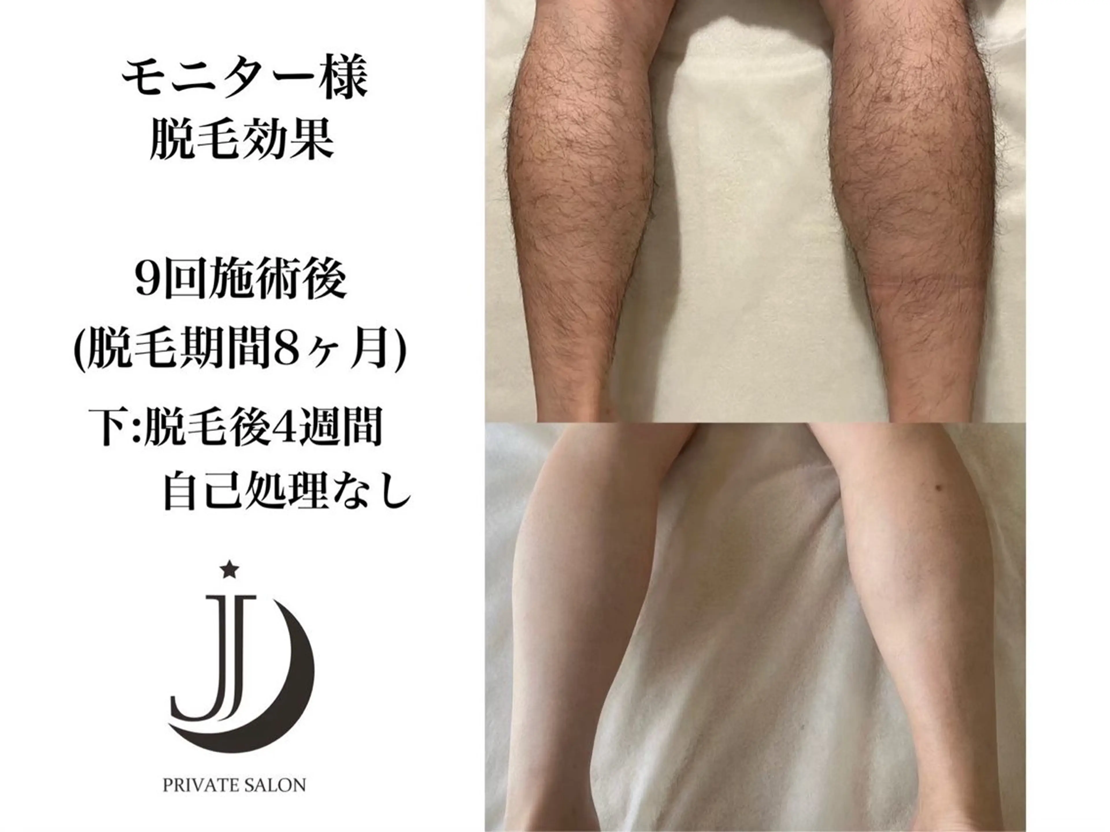 脱毛 private salon Jのエステ・リラクイメージ