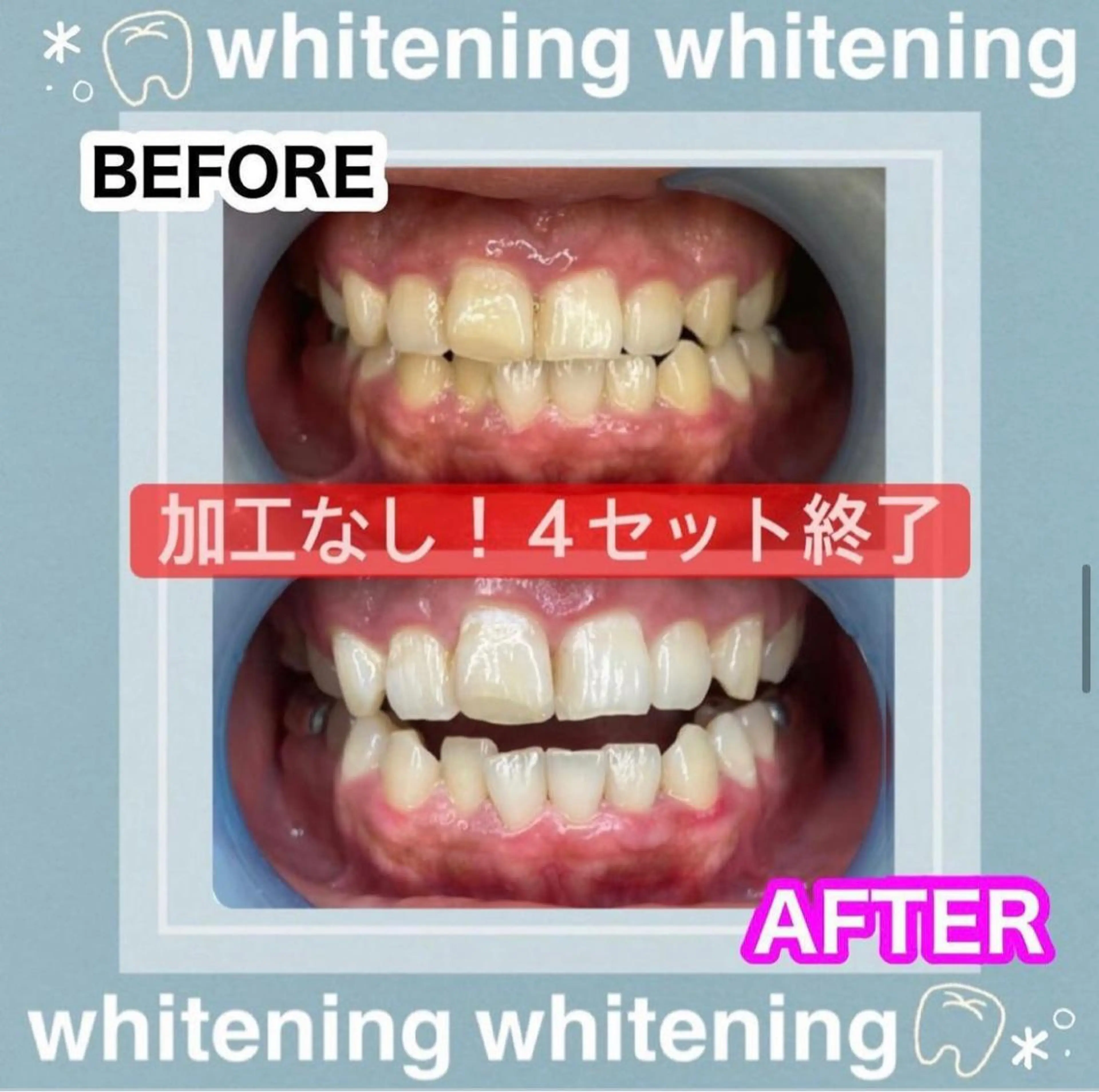 その他 LAVISH nail salonのネイルデザイン