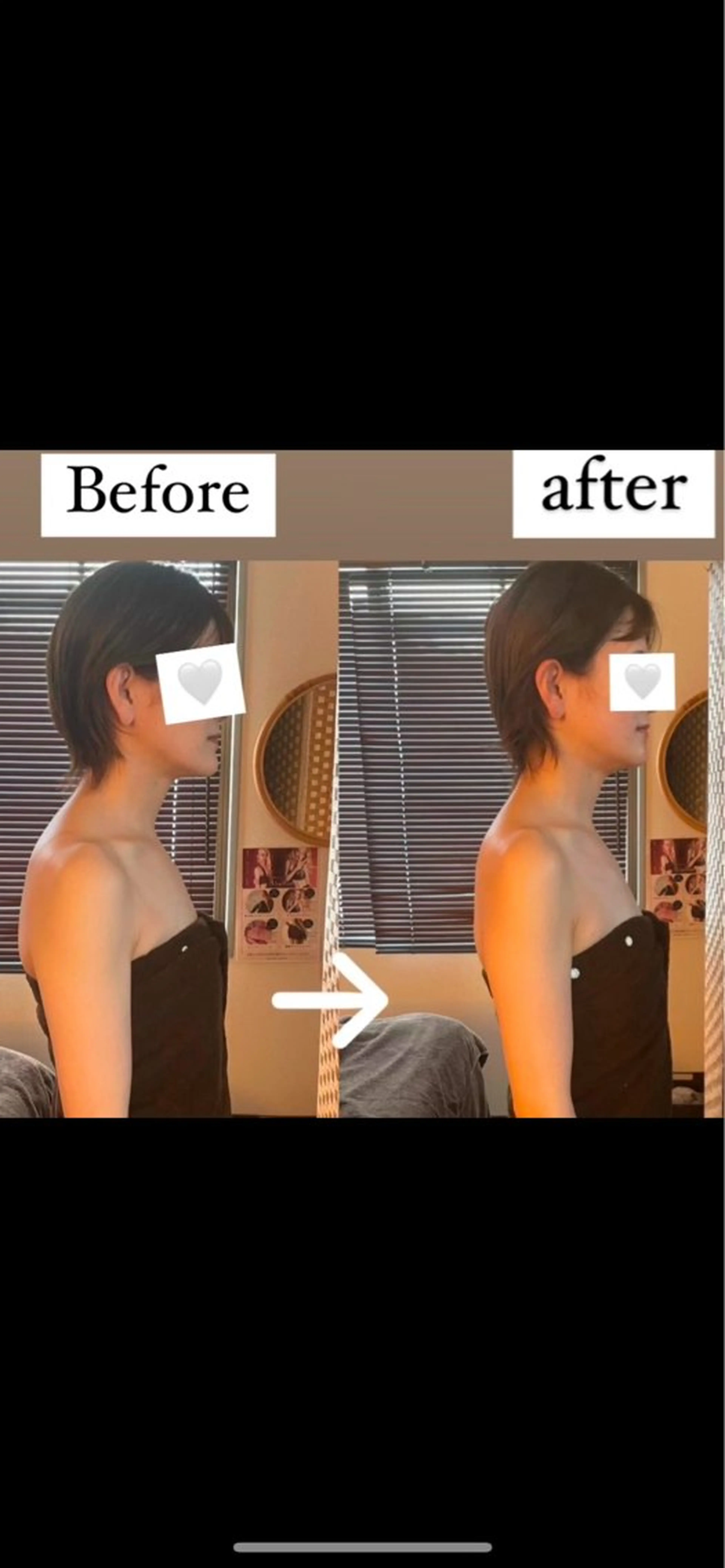 遠赤外線バザルトヘッドスパの写真