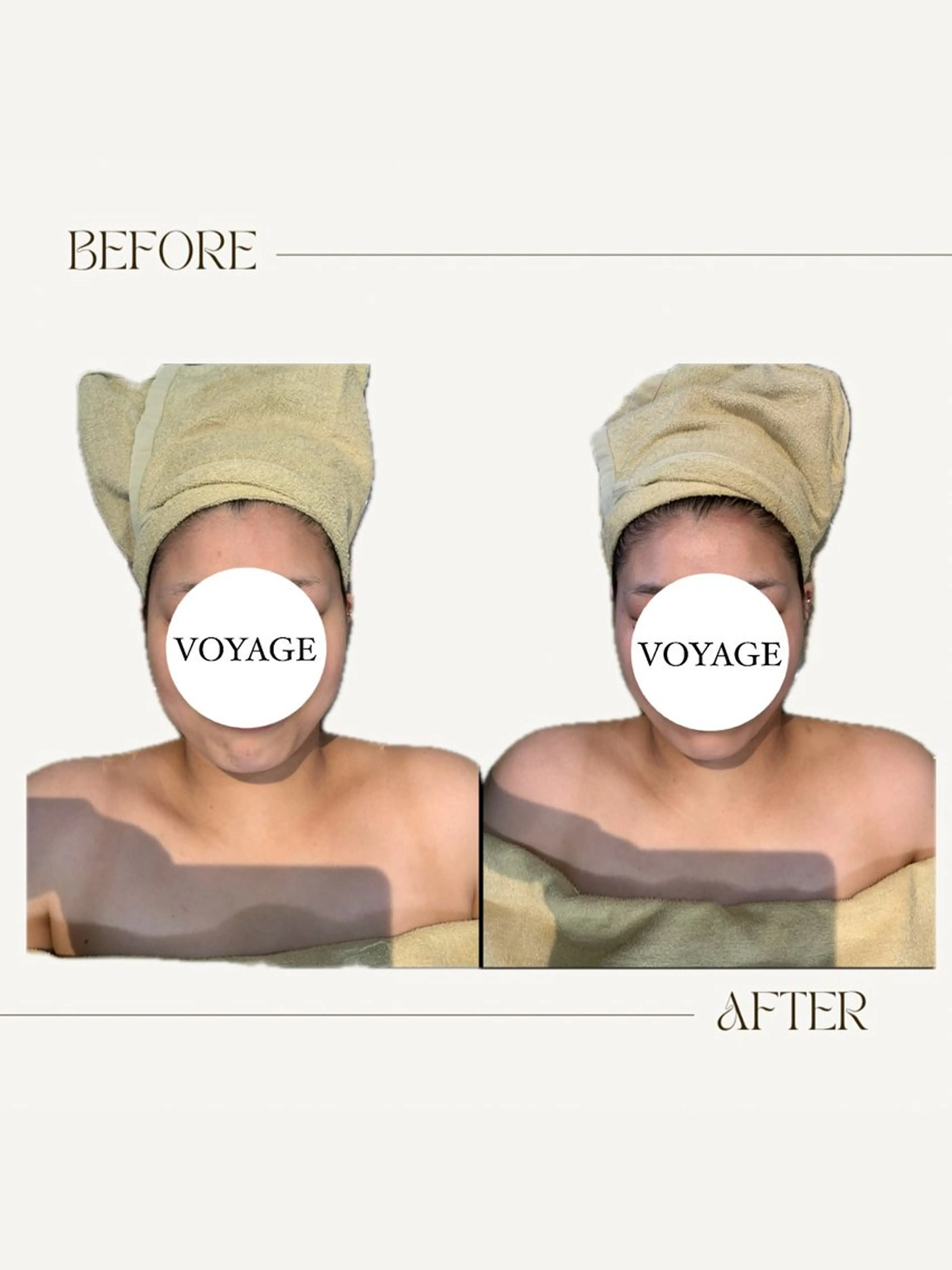 VOYAGE所属・圧倒的効果❤️‍🔥 VOYAGE ヤマダのエステ・リラクイメージ