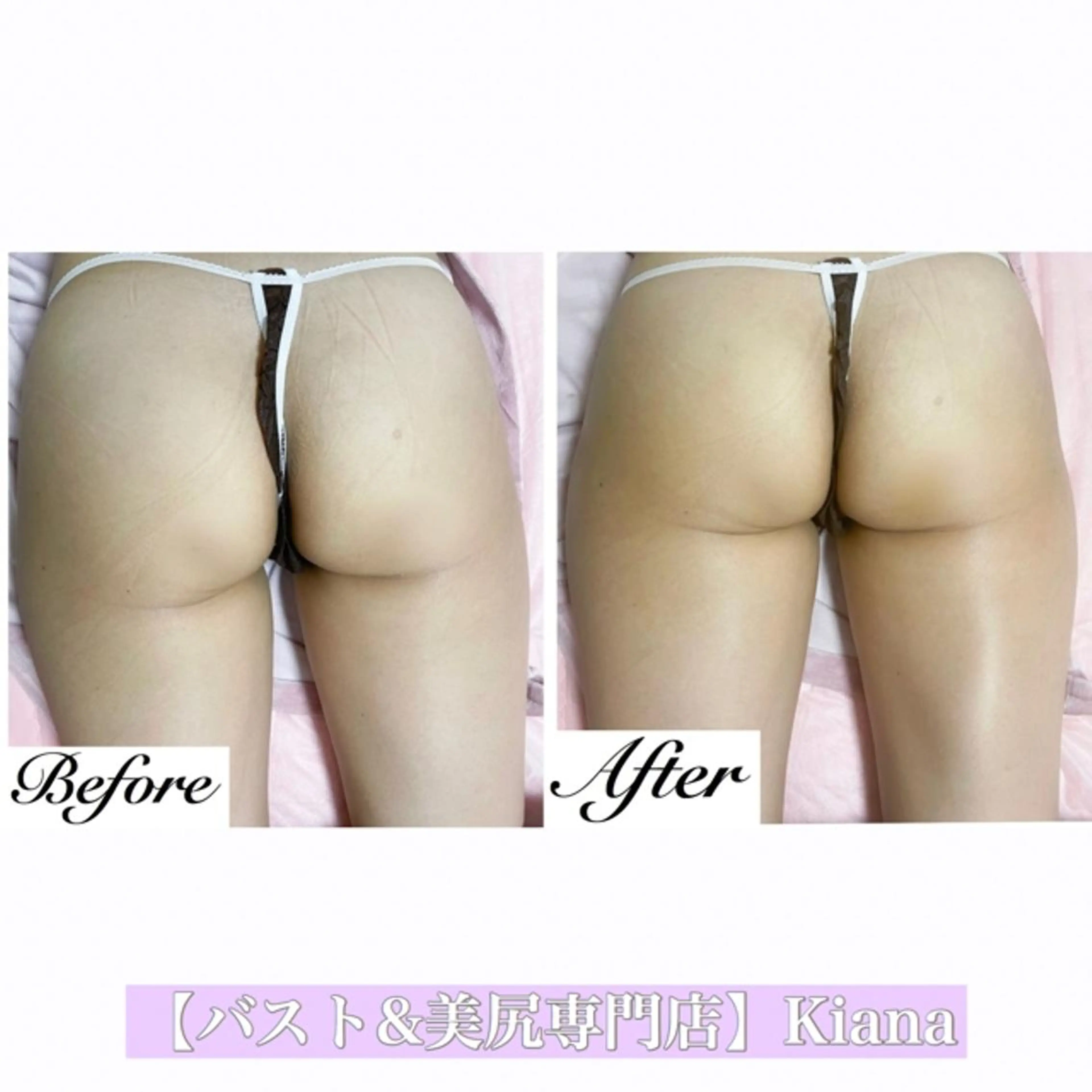 【バスト専門店 】 Kiana のエステ・リラクイメージ