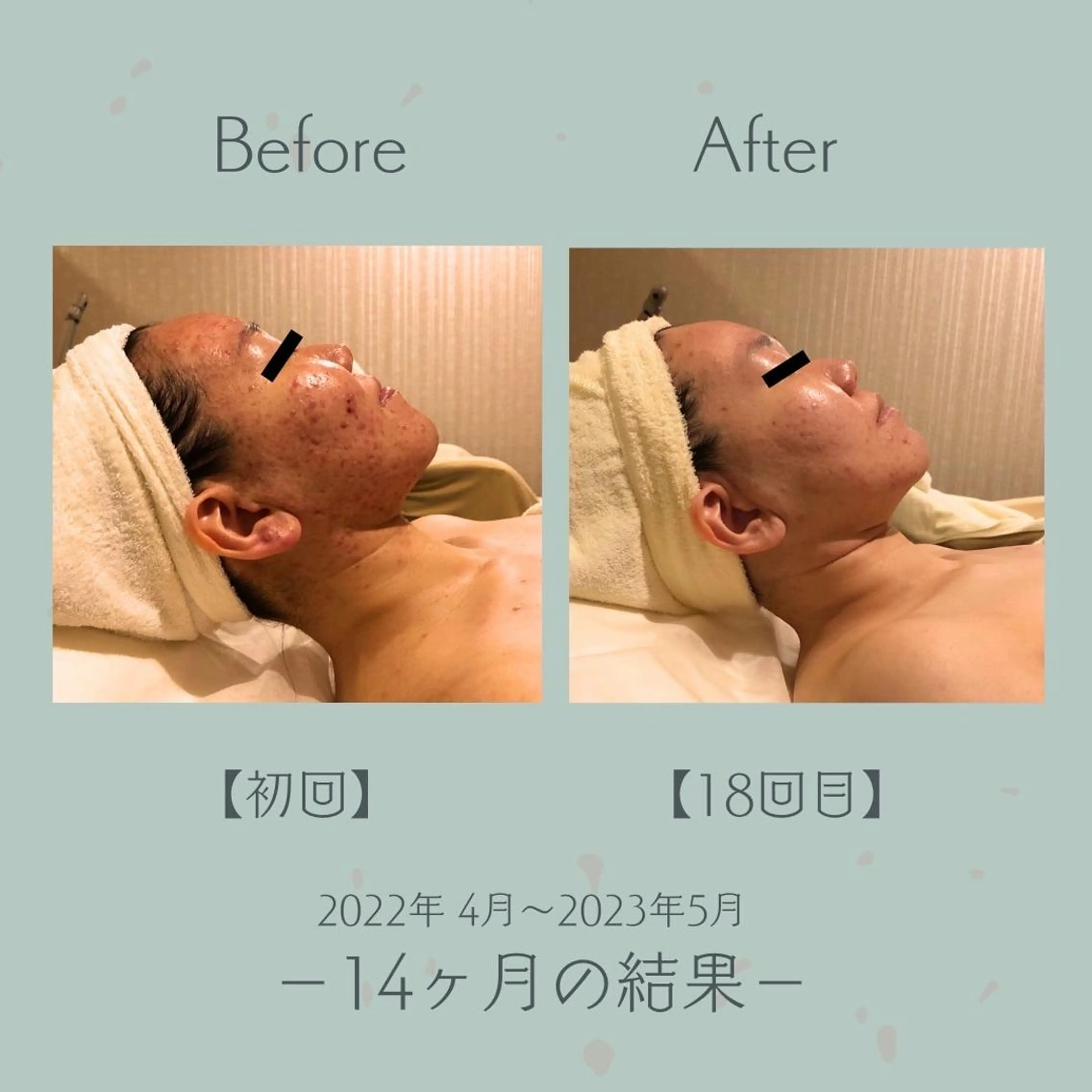 エステ＆美肌脱毛 ココサロ倉敷店のエステ・リラクイメージ