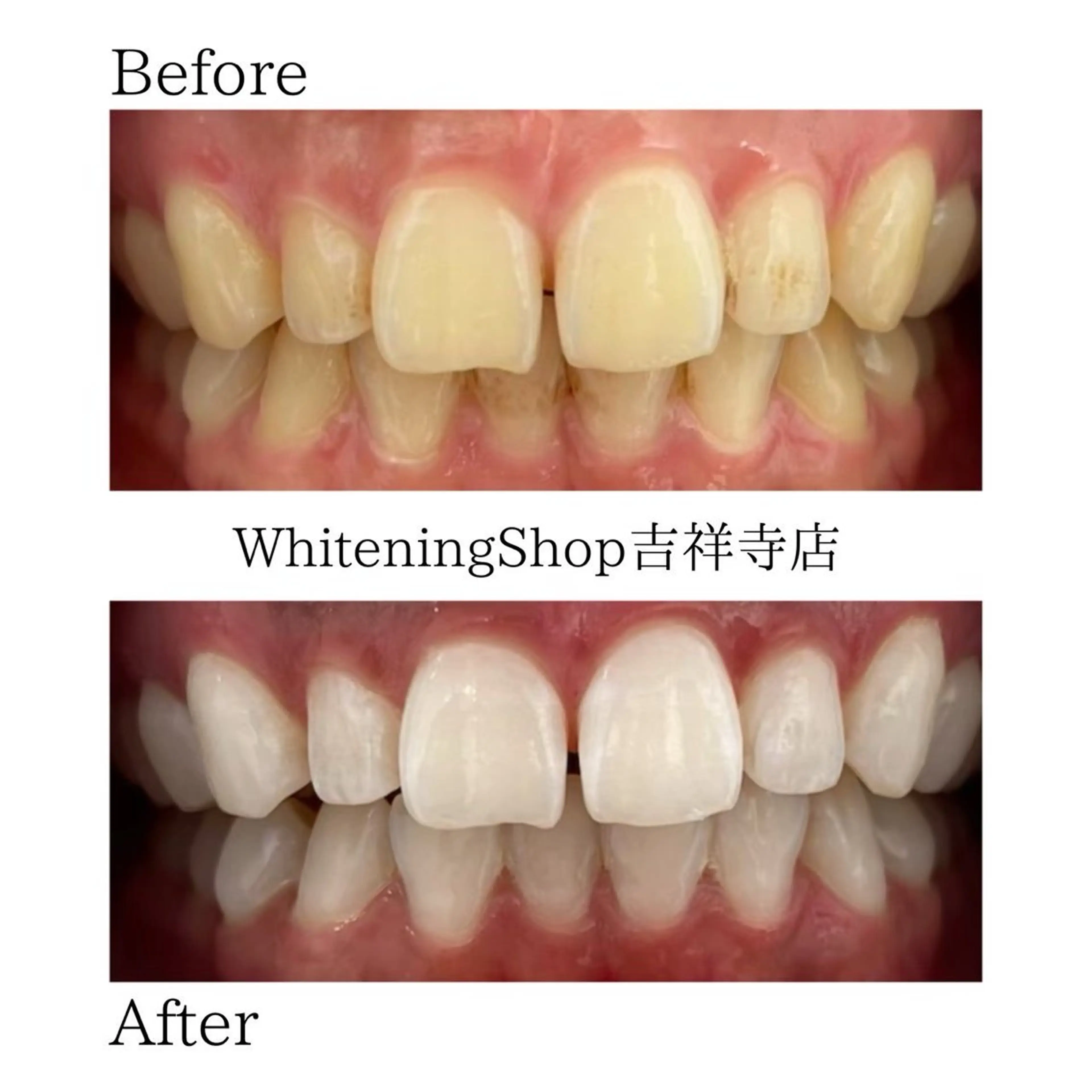 ホワイトニングショッ 吉祥寺2号店のその他イメージ