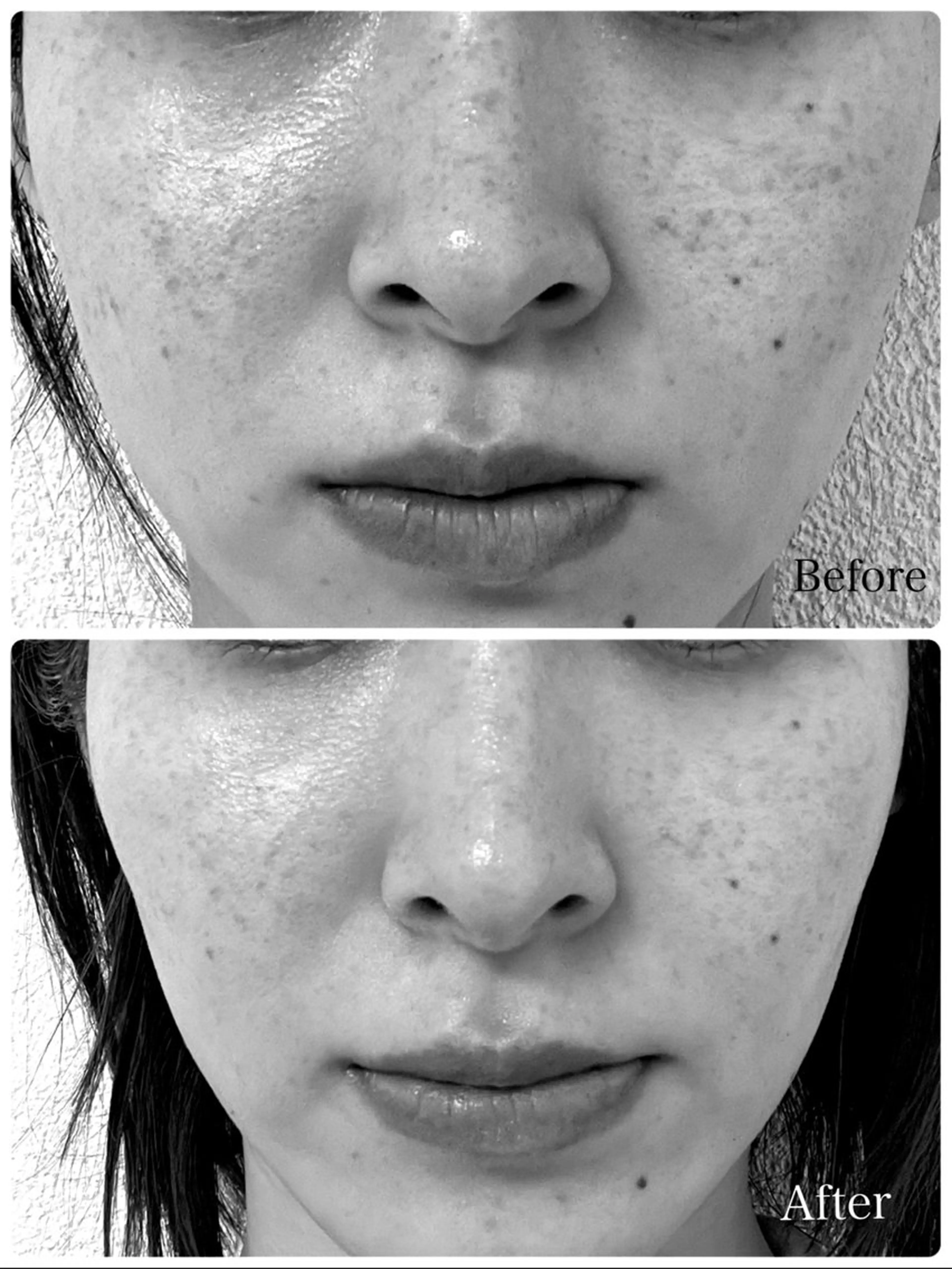 エステ エステサロン sirokaのエステ・リラクイメージ