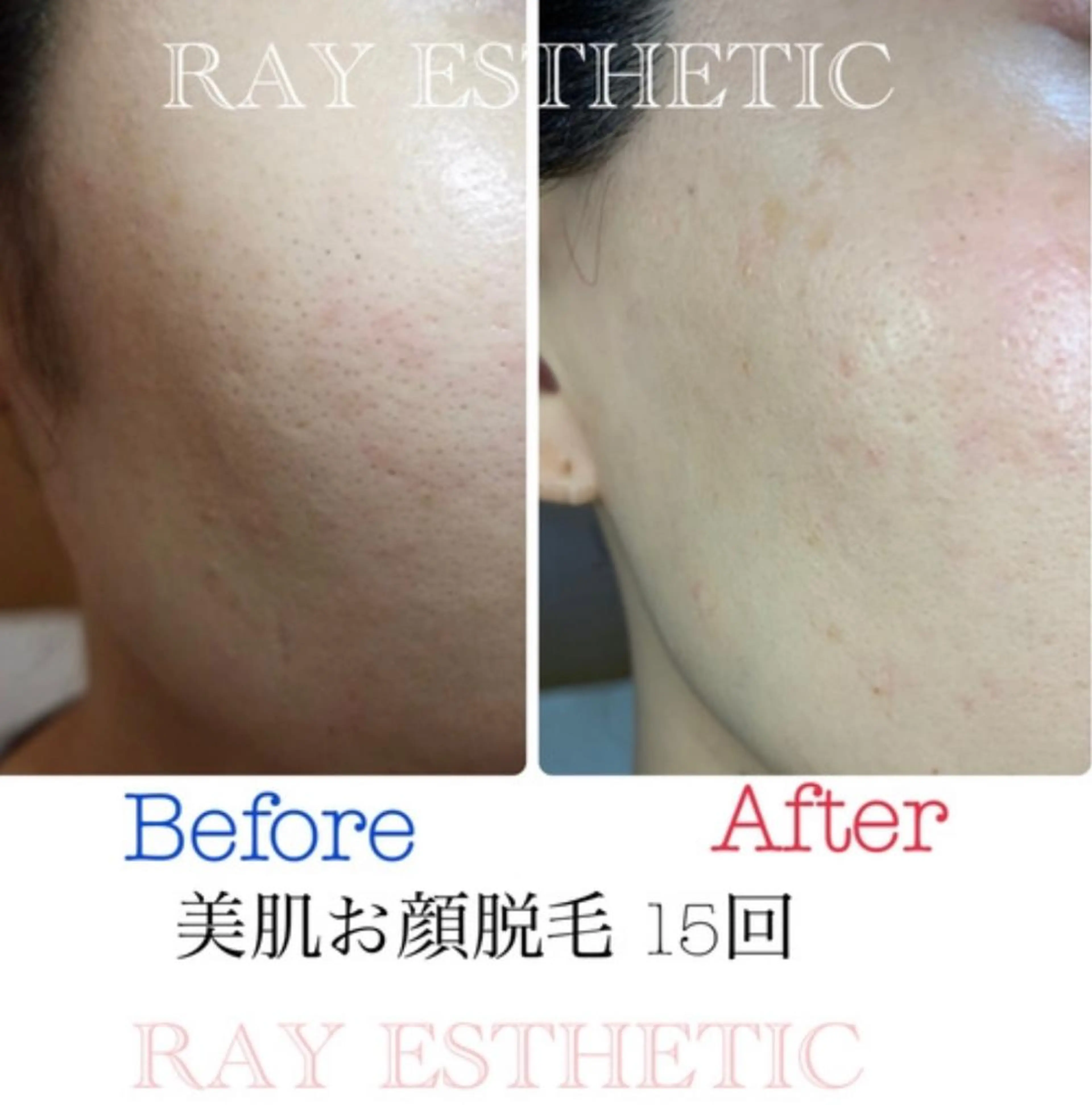 ネイル マツエク・マツパ レイフィールド江南店所属・レイエステティック 江南店のエステ・リラクイメージ