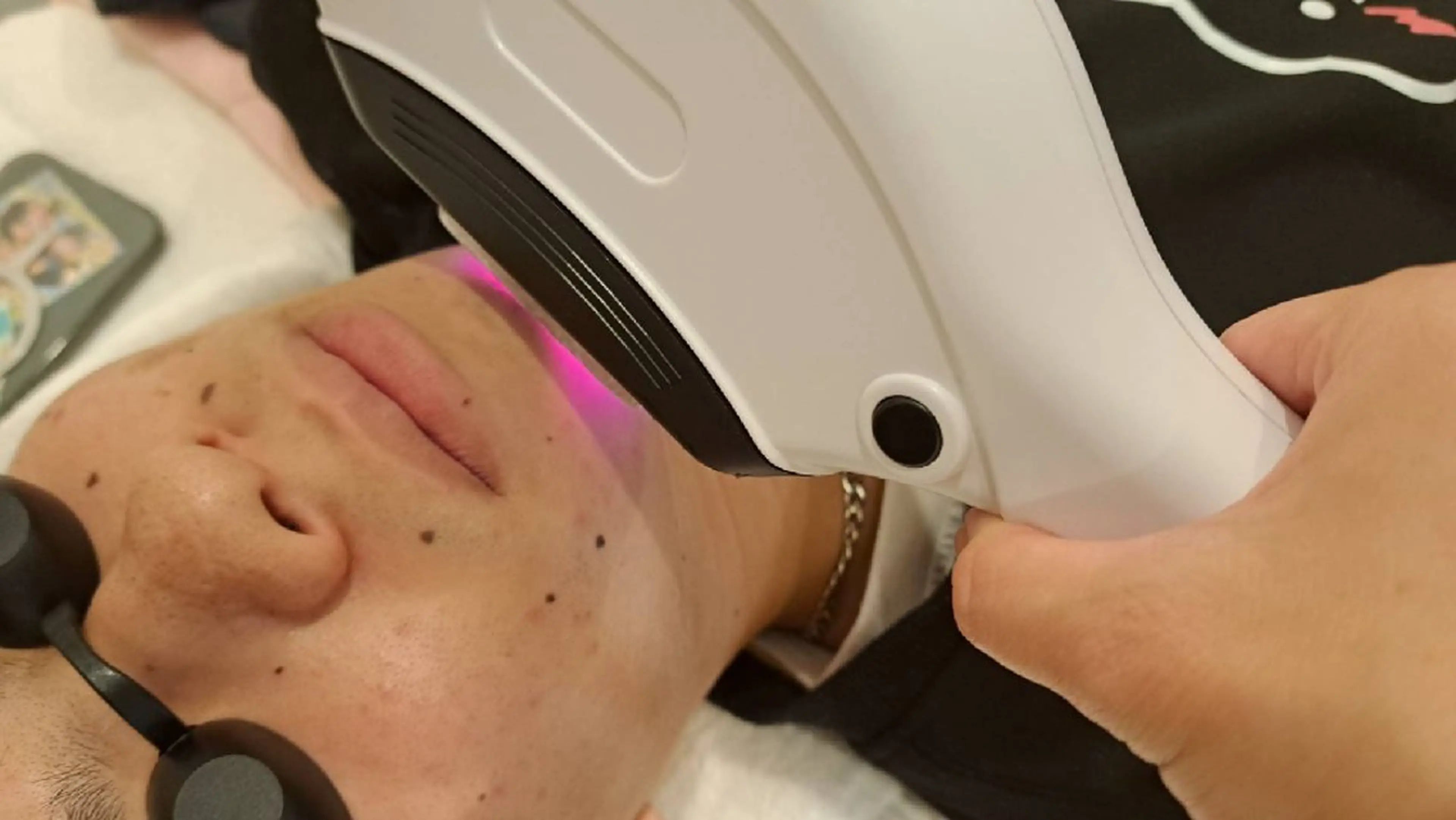 脱毛 マシュマロバスト coucouのエステ・リラクイメージ