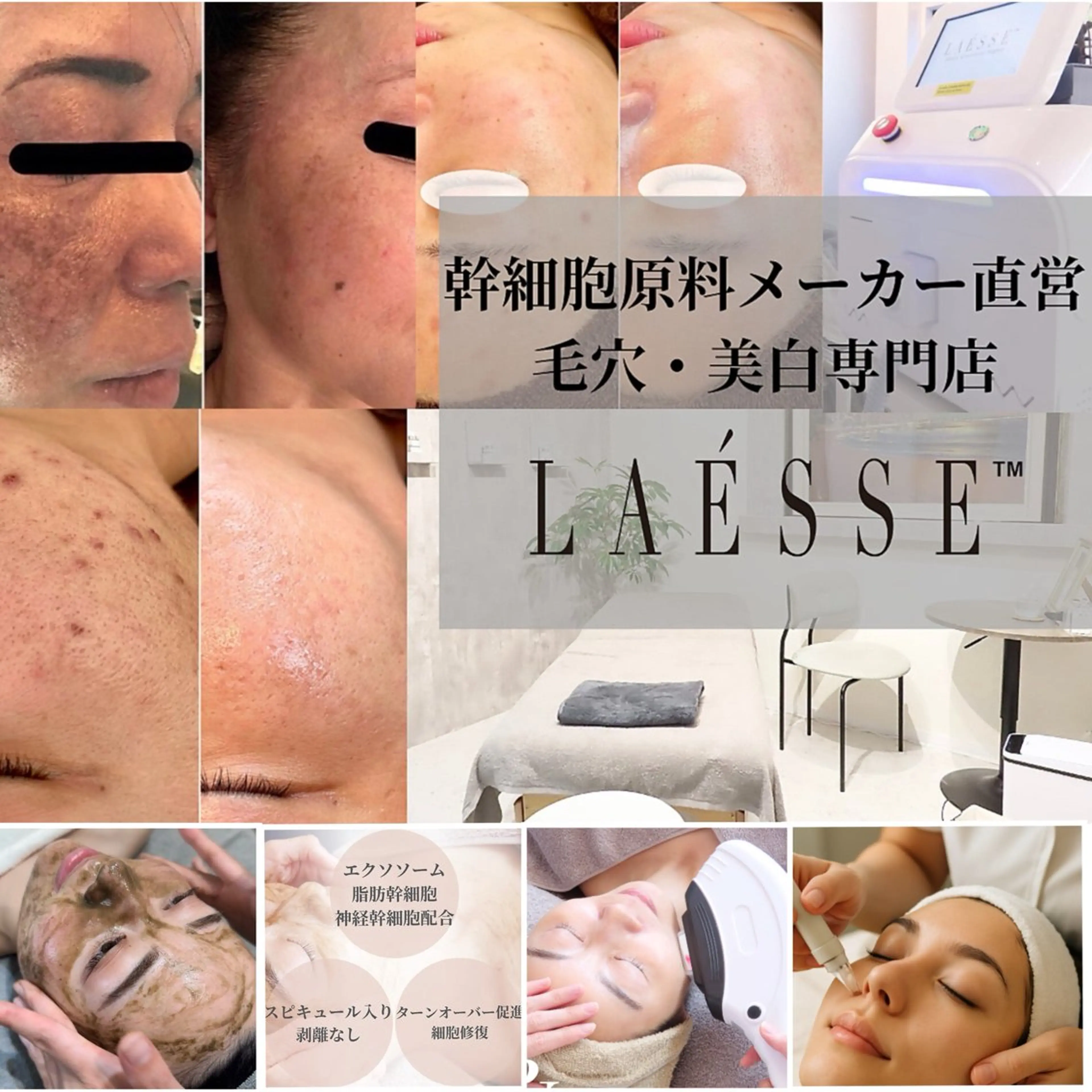 LAESSE 恵比寿所属・毛穴と美白の専門店 LAESSE 恵比寿のエステ・リラクイメージ