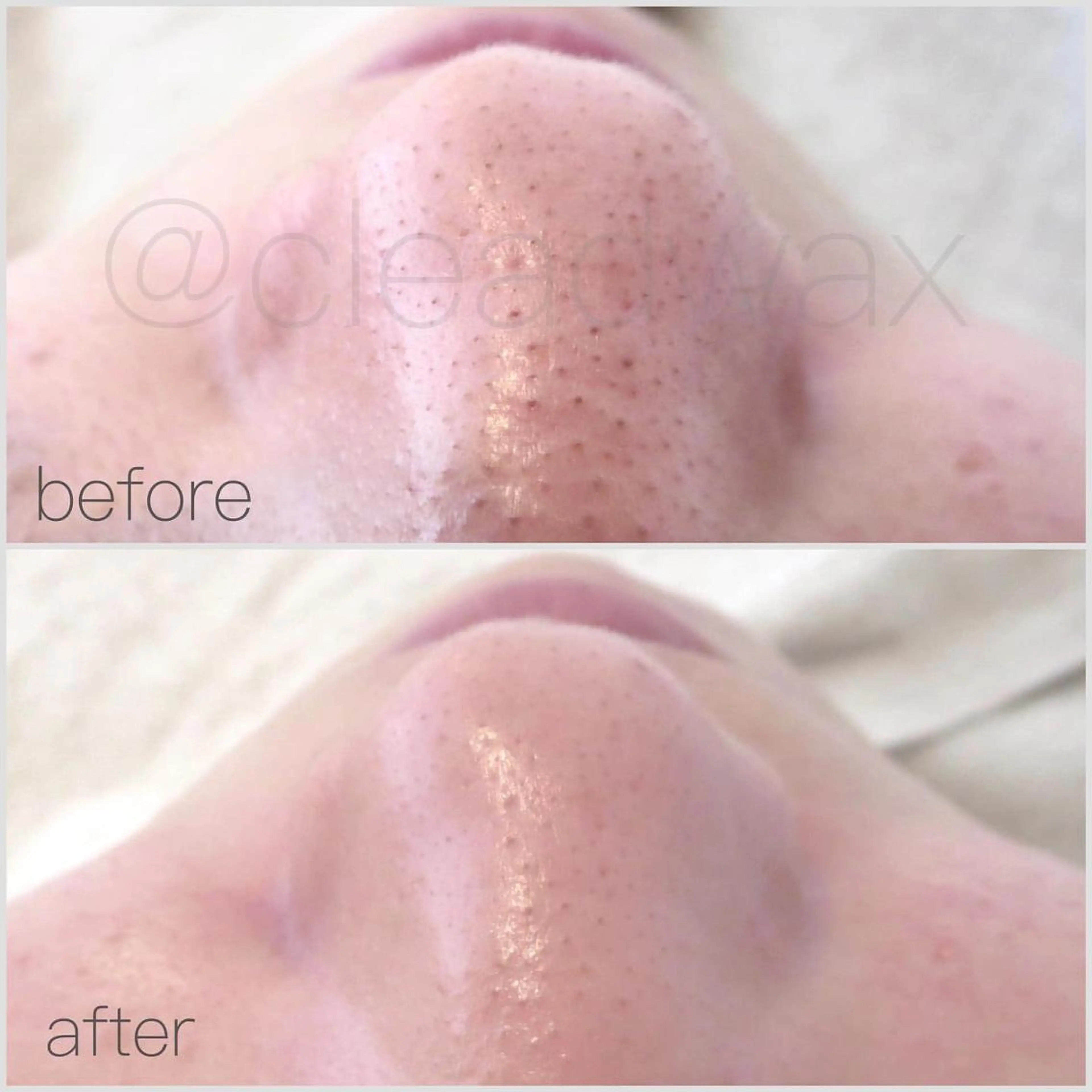 CLEAD赤坂見附店 坂田のエステ・リラクイメージ