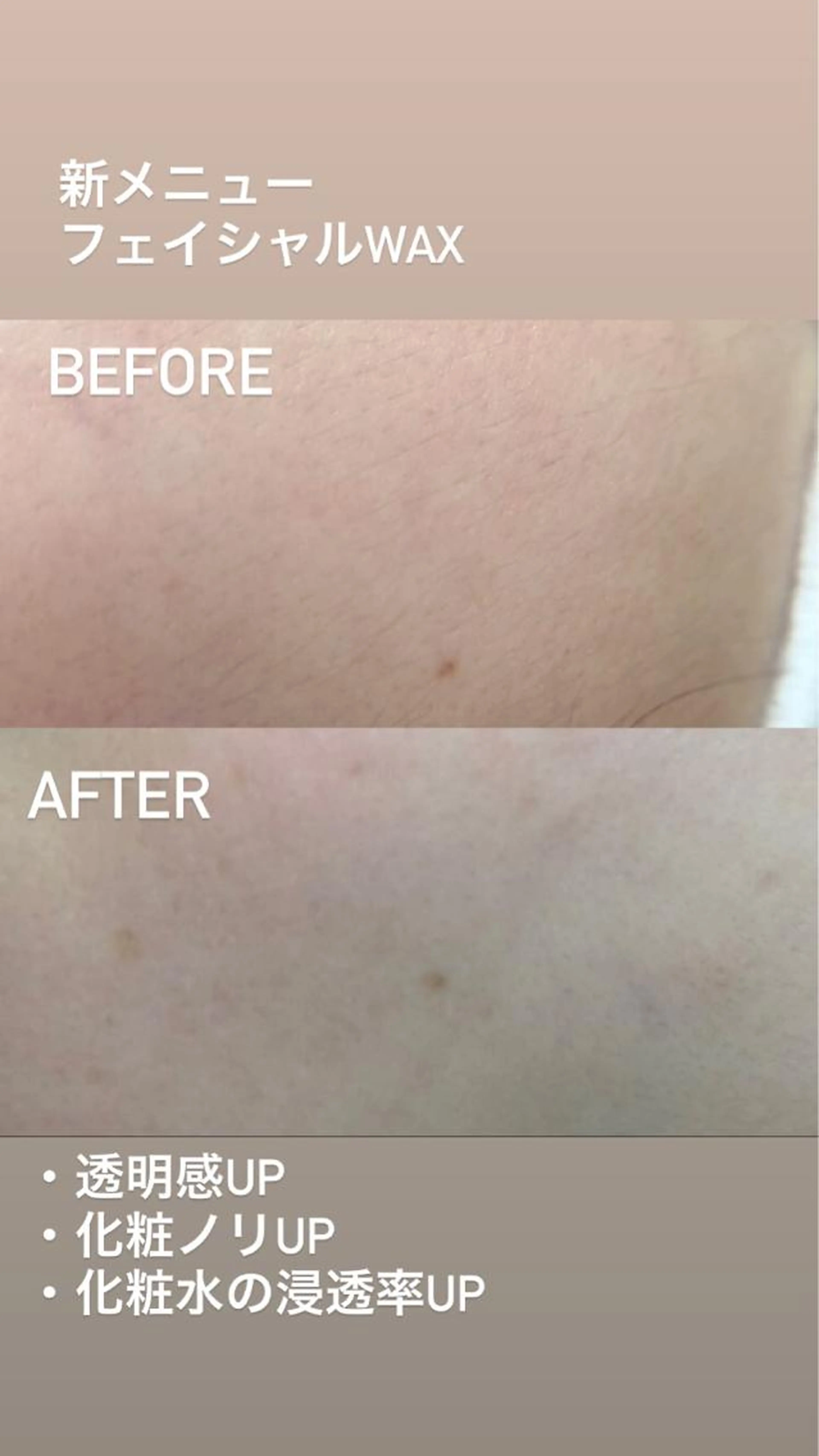 フェイシャルWaxの写真