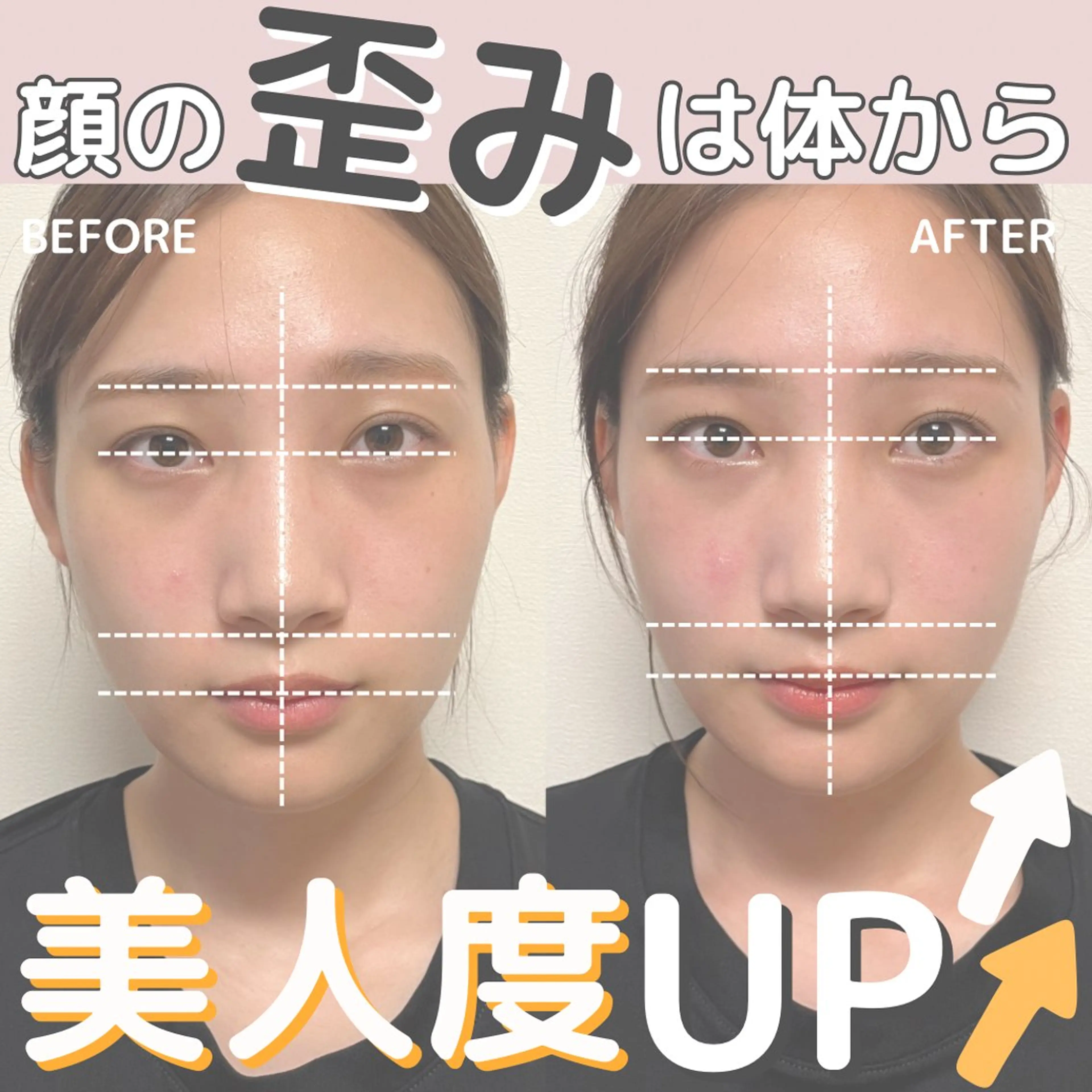 小顔矯正/骨格矯正 AKANEのエステ・リラクイメージ