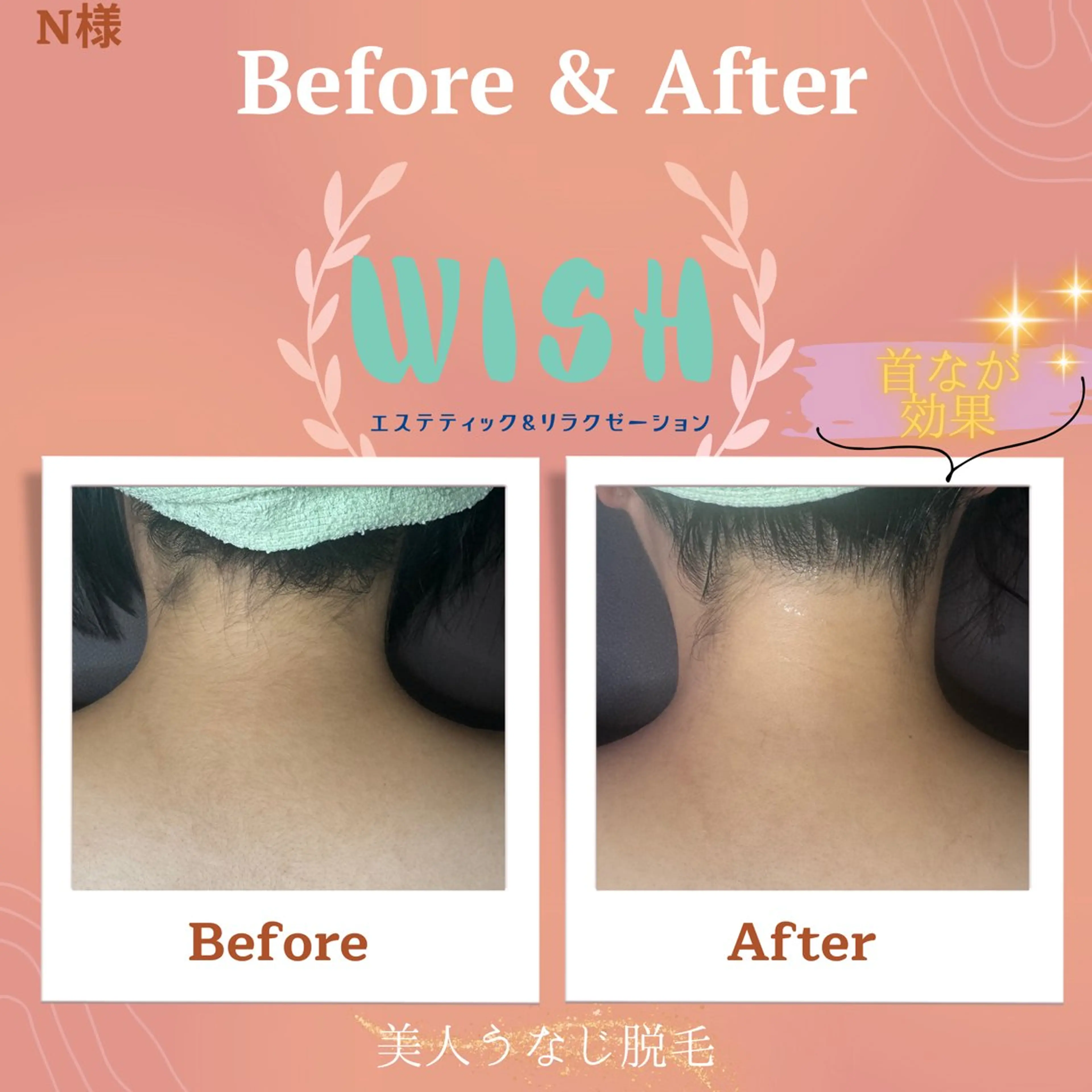 WISH 美肌脱毛のプロ！須藤のエステ・リラクイメージ