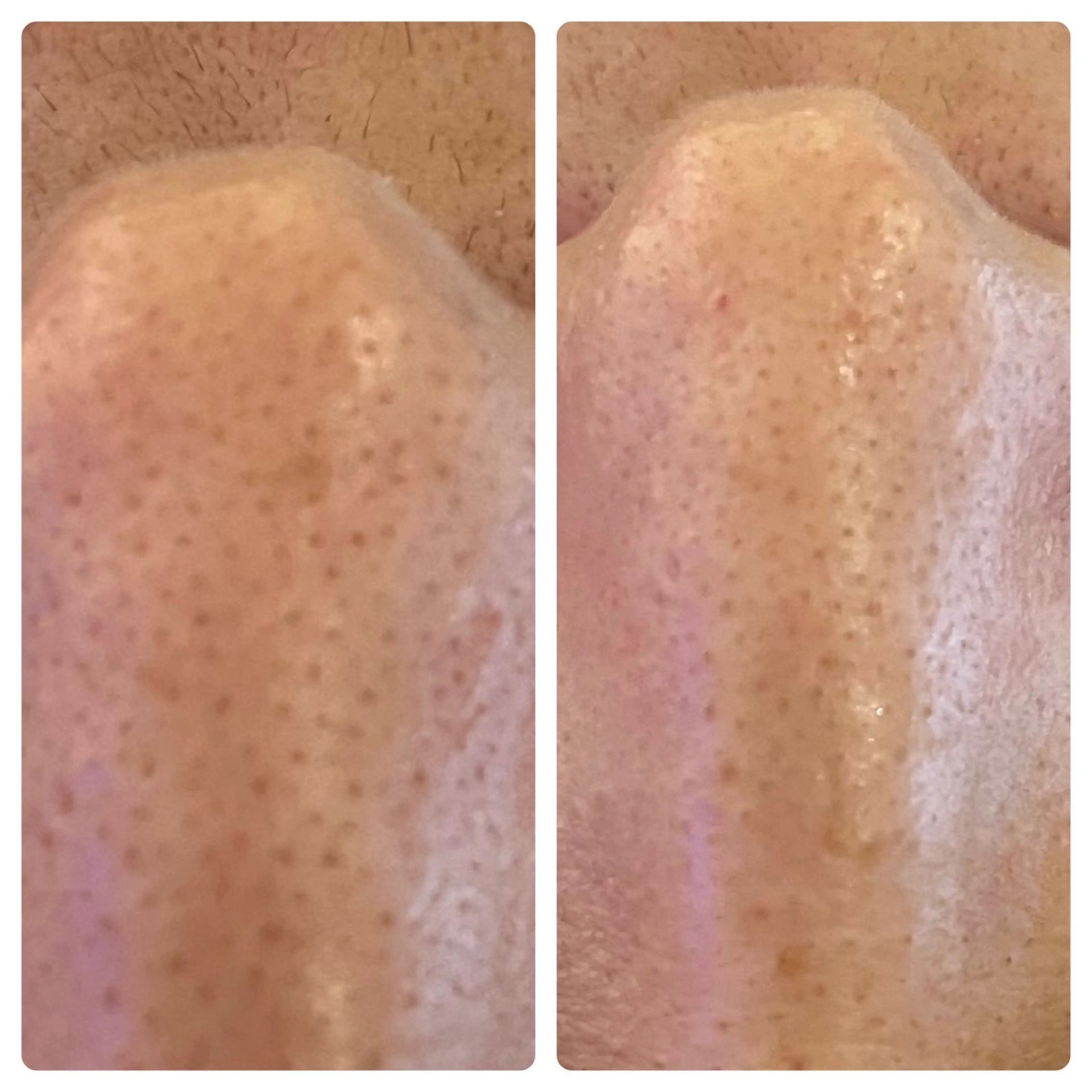 Blue Moon 【ブルームーン】のエステ・リラクイメージ