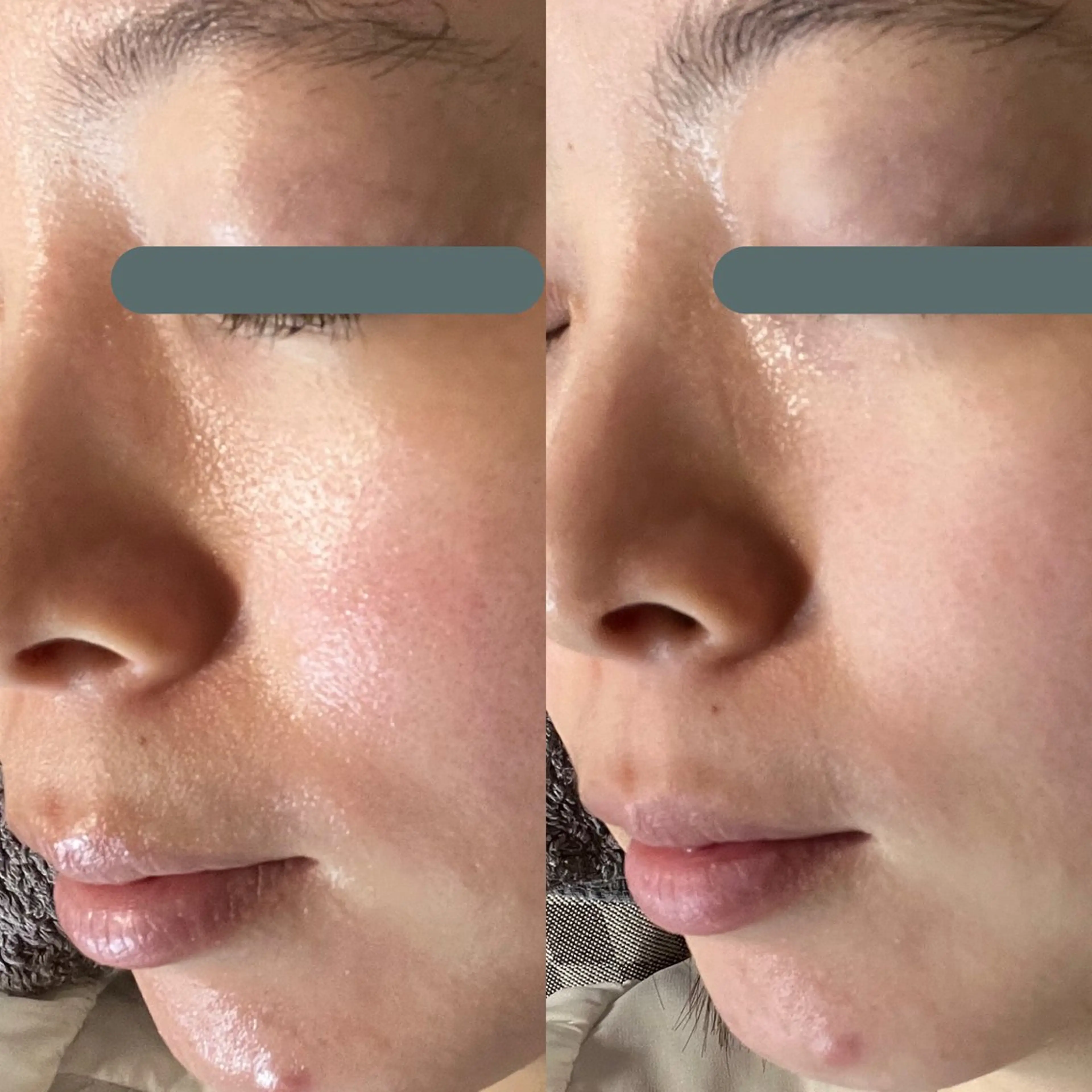 エステ リラク デアイム東広島所属・中井 小春のエステ・リラクイメージ