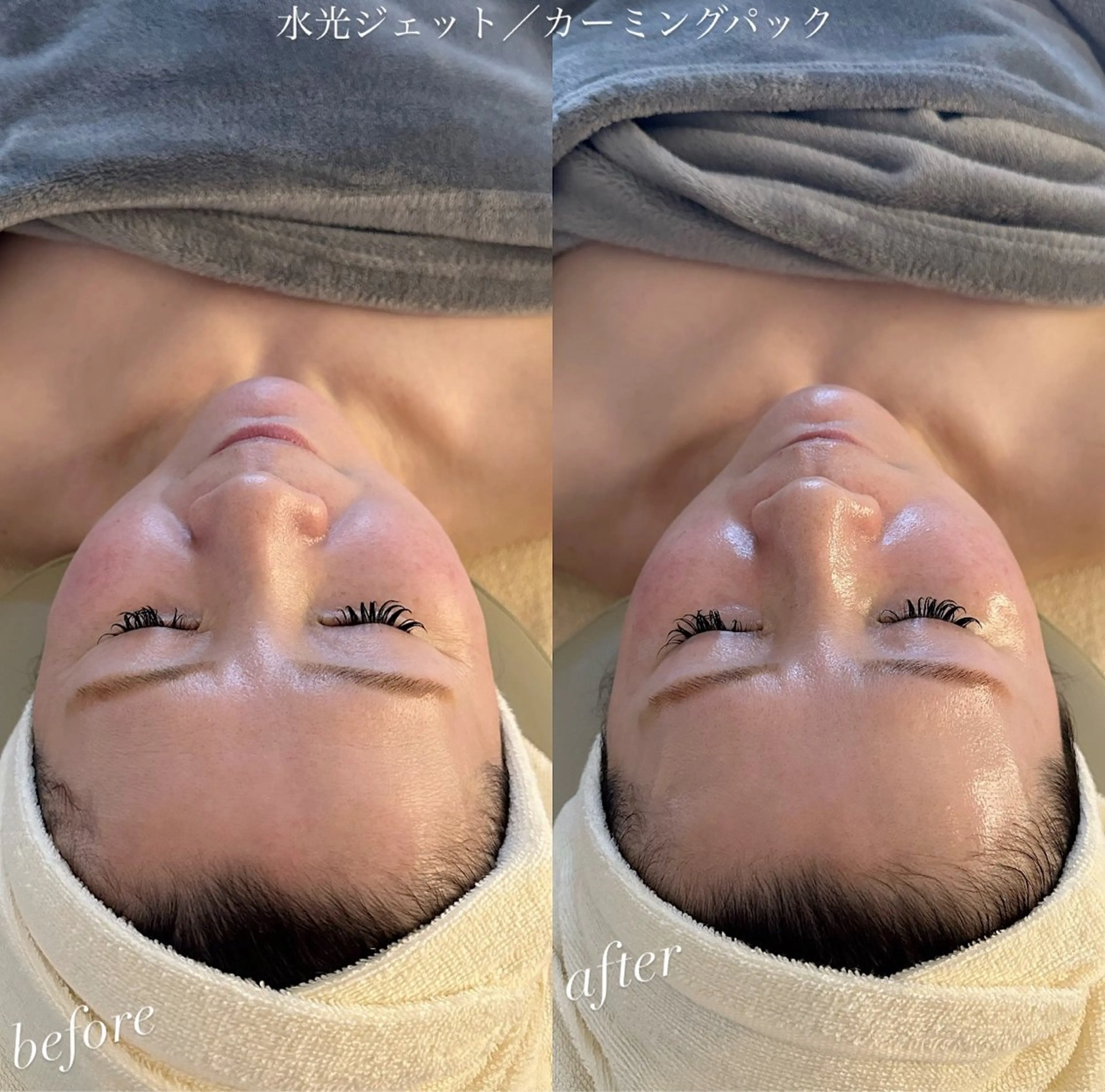 エステ うなじ脱毛/美肌脱毛 LABELのエステ・リラクイメージ