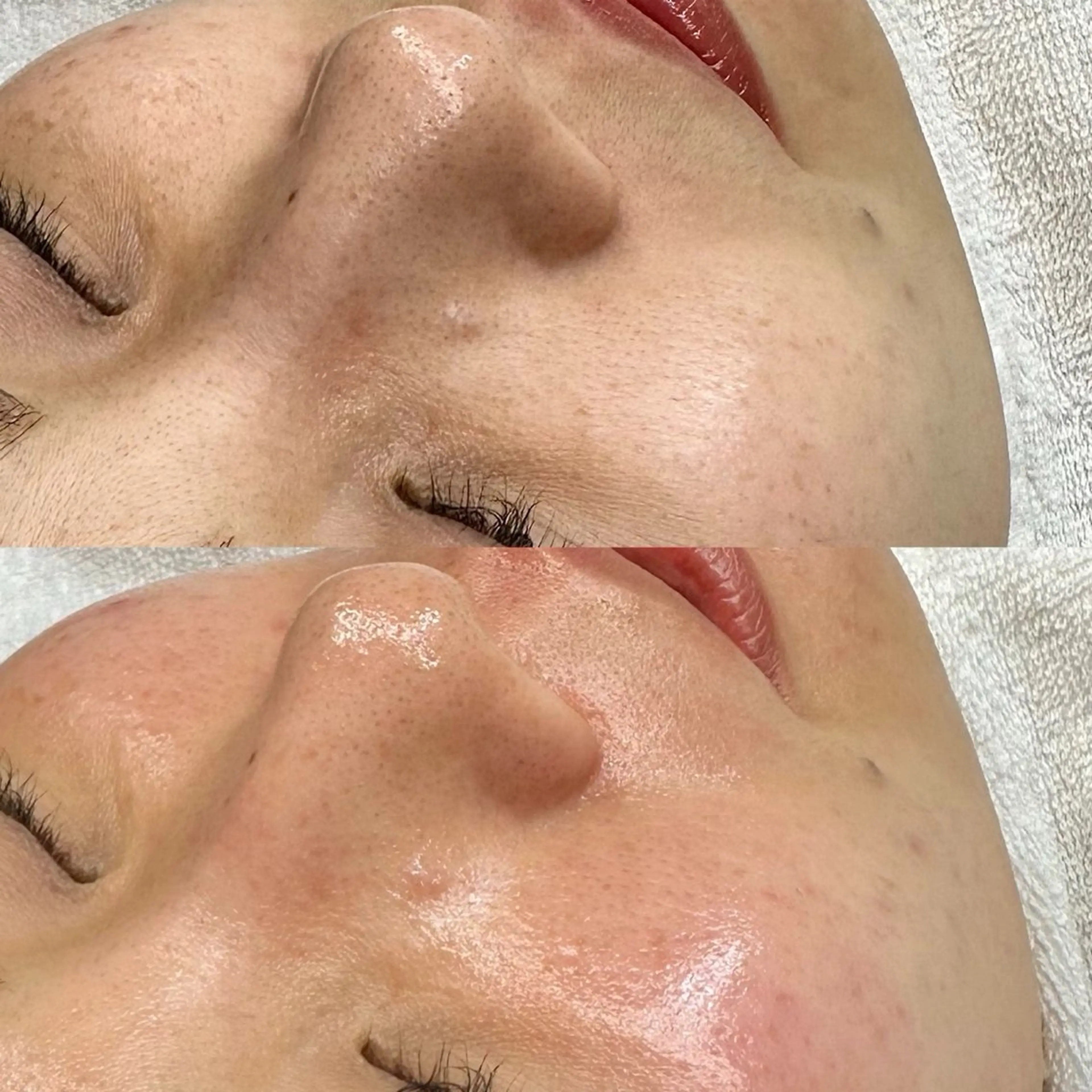 エステ Lei beauty salon所属・松ヤニワックス専門/ 梅田/Leiのエステ・リラクイメージ