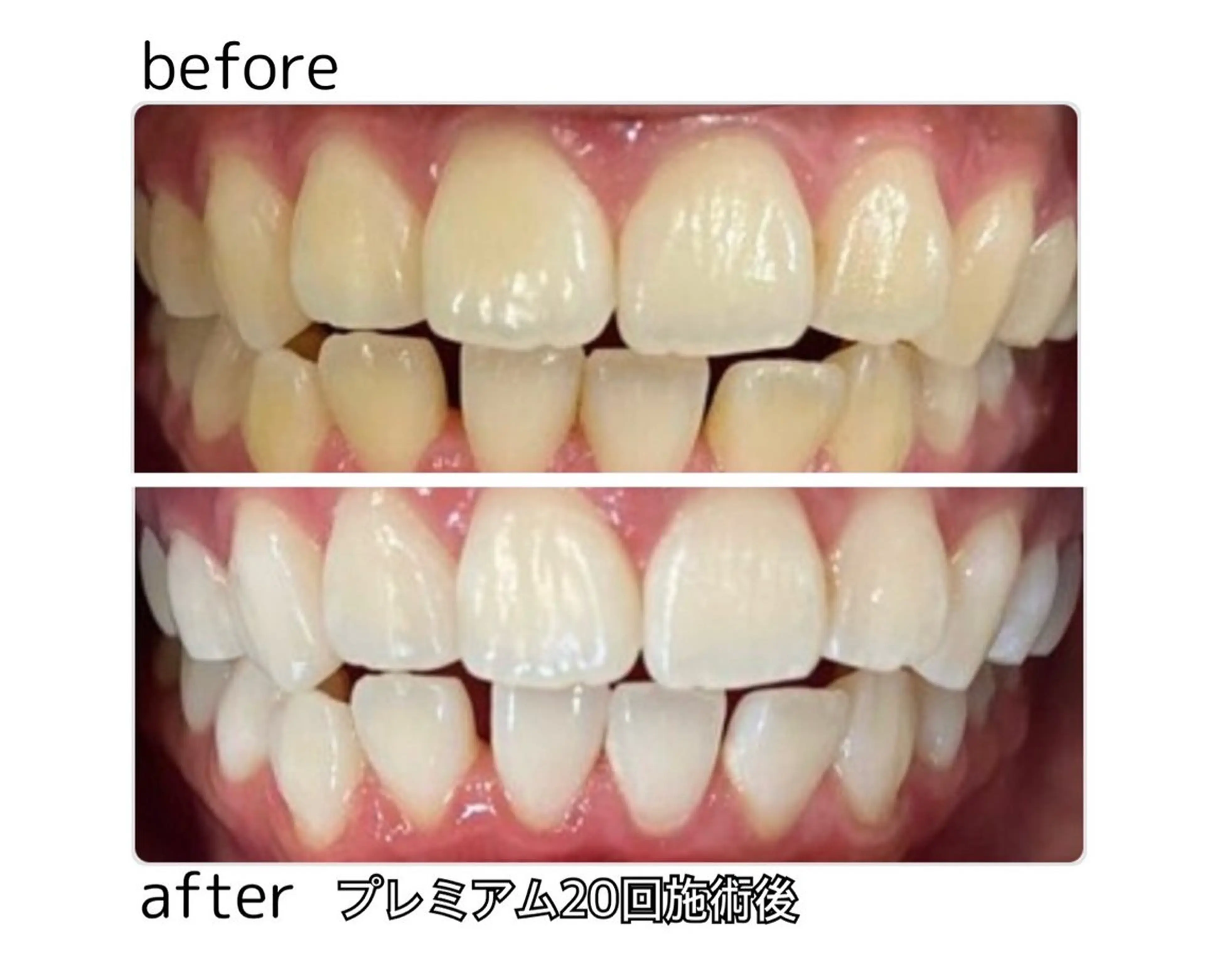 凛 リンのネイルデザイン